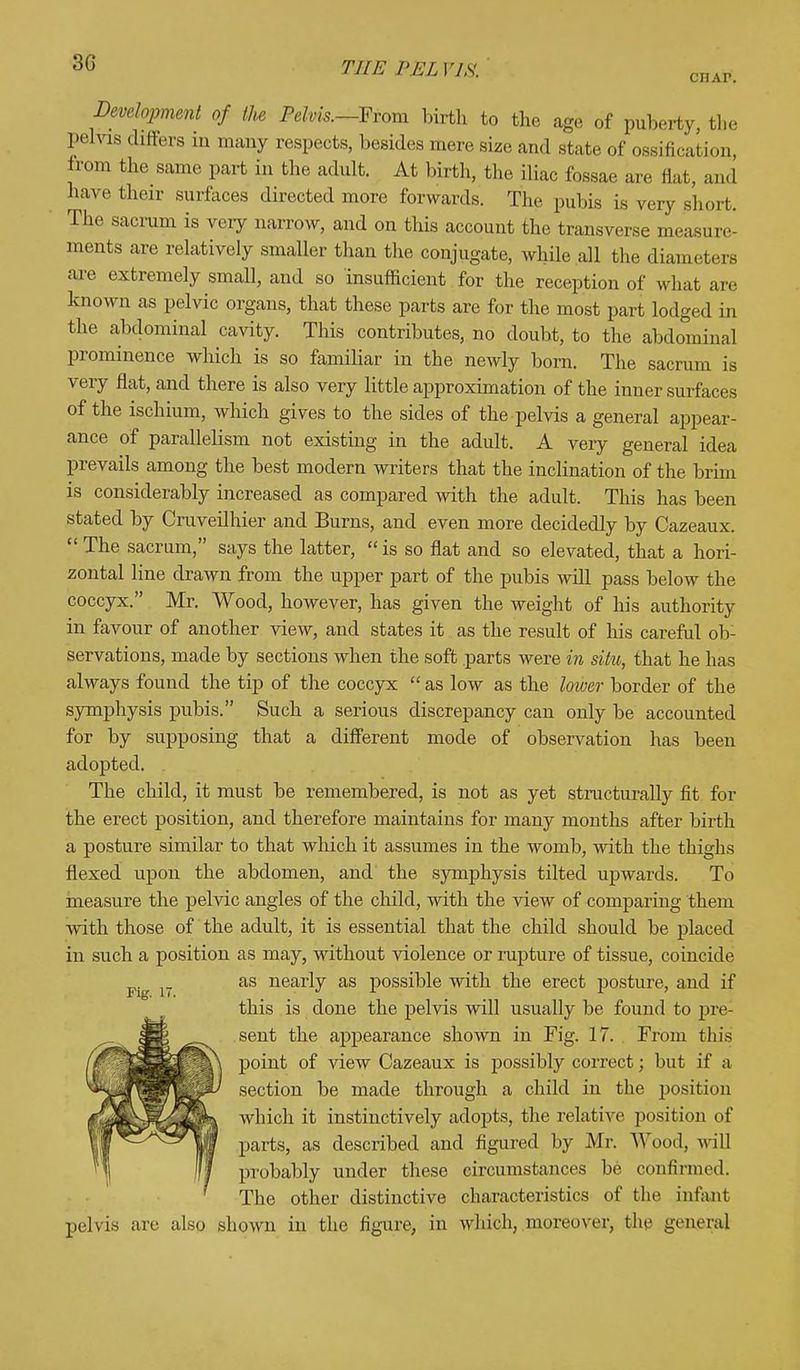 ciiAr. Development of the Pelvis.—From birth to the age of puberty, the pelvis differs in many respects, besides mere size and state of ossification, from the same part in the adult. At birth, the iliac fossae are flat, and have their surfaces directed more forwards. The pubis is very short. The sacrum is very narrow, and on this account the transverse measure- ments are relatively smaller than the conjugate, while all the diameters axe extremely small, and so insufficient for the reception of what are known as pelvic organs, that these parts are for the most part lodged in the abdominal cavity. This contributes, no doubt, to the abdominal prominence which is so familiar in the newly born. The sacrum is very flat, and there is also very little approximation of the inner surfaces of the ischium, which gives to the sides of the pelvis a general appear- ance of parallelism not existing in the adult. A very general idea prevails among the best modern writers that the inclination of the brim is considerably increased as compared with the adult. This has been stated by Cruveilhier and Burns, and even more decidedly by Cazeaux.  The sacrum, says the latter,  is so flat and so elevated, that a hori- zontal line drawn from the upper part of the pubis will pass below the coccyx. Mr. Wood, however, has given the weight of his authority in favour of another view, and states it as the result of his careful ob- servations, made by sections when the soft parts were in situ, that he has always found the tip of the coccyx  as low as the lower border of the symphysis pubis. Such a serious discrepancy can ouly be accounted for by supposing that a different mode of observation has been adopted. . The child, it must be remembered, is not as yet structurally fit for the erect position, and therefore maintains for many months after birth a posture similar to that which it assumes in the womb, with the thighs flexed upon the abdomen, and the symphysis tilted upwards. To measure the pelvic angles of the child, with the view of comparing them with those of the adult, it is essential that the child should be placed in such a position as may, without violence or rupture of tissue, coincide Fig 17 as nearty as possible with the erect posture, and if this is done the pelvis will usually be found to pre- sent the appearance shown in Fig. 17. From this point of view Cazeaux is possibly correct; but if a section be made through a child in the position which it instinctively adopts, the relative position of parts, as described and figured by Mr. Wood, will probably under these circumstances be confirmed. The other distinctive characteristics of the infant pelvis are also shown in the figure, in which, moreover, the general