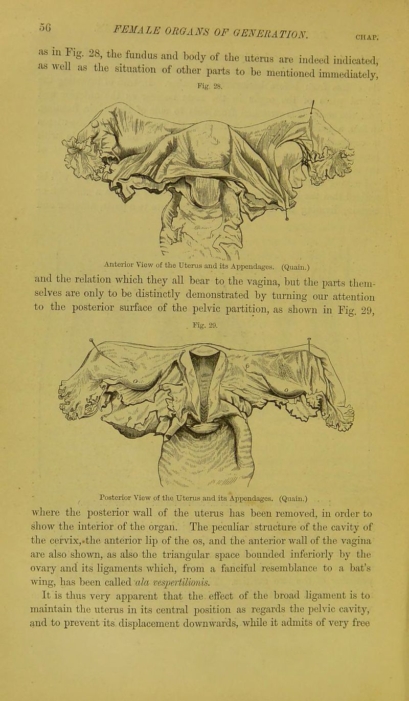 CHAP. FEMALE ORGANS OF GENERATION. as in Fig. 28 the fundus and body of the uterus are indeed indicated; as well as the situation of other parts to be mentioned immediately, Fig. 28. Anterior View of the Uterus and its Appendages. (Quain.) and the relation which they all bear to the vagina, but the parts them- selves are only to be distinctly demonstrated by turning our attention to the posterior surface of the pelvic partition, as shown in Fig. 29, . Fig. 29. Posterior View of the Uterus and its Appendages. (Quain.) where the posterior wall of the uterus has been removed, in order to show the interior of the organ. The peculiar structure of the cavity of the cervix,.the anterior lip of the os, and the anterior wall of the vagina are also shown, as also the triangular space bounded interiorly by the ovary and its ligaments which, from a fanciful resemblance to a bat's wing, has been called ala vespertiliOTlis. It is thus very apparent that the effect of the broad ligament is to maintain the uterus in its central position as regards the pelvic cavity, and to prevent its displacement downwards, while it admits of very five