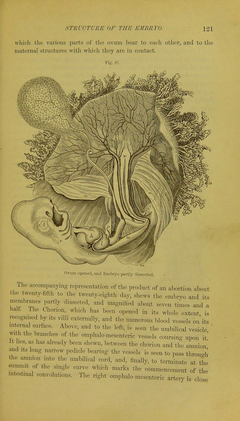 which the various parts of the ovum bear to each other, and to the maternal structures with which they are in contact. Fig. 67. Ovum opened, and Embryo partly dissected. The accompanying representation of the product of an abortion about the twenty-fifth to the twenty-eighth day, shews the embryo and its membranes partly dissected, and magnified about seven times and a naif. The Chorion, which has been opened in its whole extent, is recognised by its villi externally, and the numerous blood vessels on its internal surface. Above, and to the left, is seen the umbilical vesicle wi h the branches of the omphalomesenteric vessels coursing upon it' It lies, as has already been shewn, between the chorion and the amnion and ft long narrow pedicle bearing the vessels is seen to pass through the amnion into the umbilical cord, and, finally, to terminate at the summit of the single curve which marks the commencement of the intestinal convolutions. The right omphalomesenteric artery is close