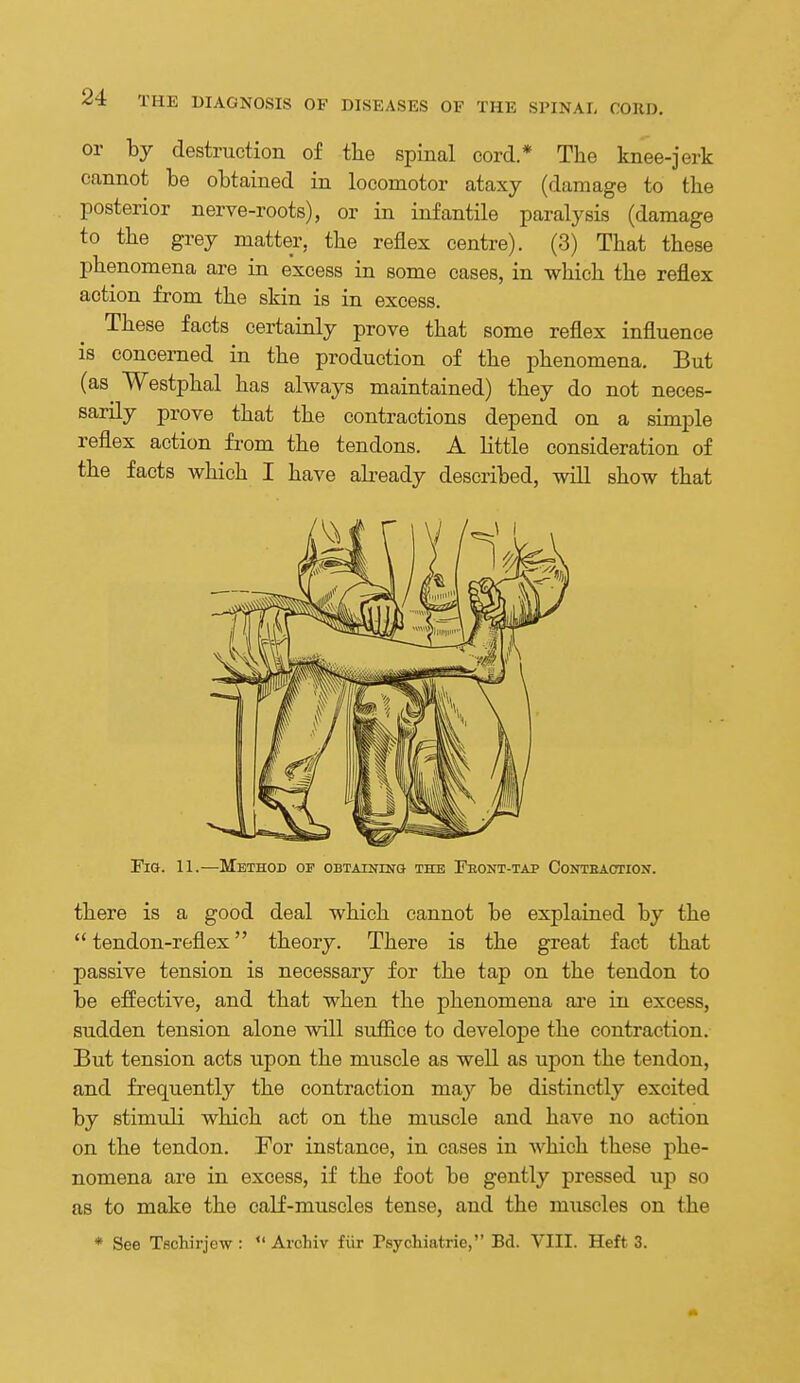 or by destruction of tlie spinal cord.* The knee-jerk cannot be obtained in locomotor ataxy (damage to the posterior nerve-roots), or in infantile paralysis (damage to the grey matter, the reflex centre). (3) That these phenomena are in excess in some cases, in which the reflex action from the skin is in excess. These facts certainly prove that some reflex influence is concerned in the production of the phenomena. But (as Westphal has always maintained) they do not neces- sarily prove that the contractions depend on a simple reflex action from the tendons. A little consideration of the facts which I have already described, will show that Fig. 11.—Method of OBTAiNrN& the Feont-tap Conteaotiox. there is a good deal which cannot be explained by the tendon-reflex theory. There is the great fact that passive tension is necessary for the tap on the tendon to be effective, and that when the phenomena ai'e iu excess, sudden tension alone will suffice to develope the contraction. But tension acts upon the muscle as well as upon the tendon, and frequently the contraction may be distinctly excited by stimuli which act on the muscle and have no action on the tendon. For instance, in cases in which these phe- nomena are in excess, if the foot be gently pressed up so as to make the calf-muscles tense, and the muscles on the * See Tschirjew : *' Archiv fiir Tsychiatrie, Bd. VIII. Heft 3.