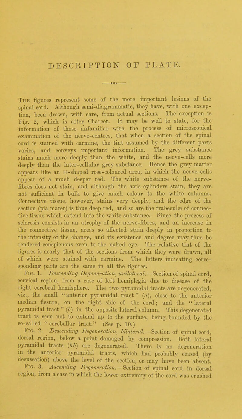 DESCEIPTION OF PLATE. The figures represent some of tlie more important lesions of the spinal cord. Althoug-h semi-diagrammatic, they have, with one excep- tion, been drawn, vdth care, from actual sections. The exception is Fig. 2, which is after Charcot. It may he well to state, for the information of those linfamiliar -ndth the process of microscopical examination of the nerve-centres, that when a section of the spinal cord is stained with carmine, the tint assumed by the different parts varies, and conveys important information. The gi-ey s\ibstance stains much more deeply than the white, and the nerve-cells more deeply than the inter-cellular grey substance. Hence the grey matter appears like an H-shaped rose-coloured area, in which the nerve-ceUs appear of a much deeper red. The white substance of the nerve- fibres does not stain, and although the axis-cylinders stain, they are not sufiicient in bulk to give much colour to the white columns. Connective tissue, however, stains very deeply, and the edge of the section (pia mater) is thus deep red, and so are the trabeculre of connec- tive tissiie which extend into the white substance. Since the process of sclerosis consists in an atrophy of the nerve-fibres, and an increase in the connective tissue, areas so affected stain deeply in proportion to the intensity of the change, and its existence and degree may thus be rendered conspicuous even to the naked eye. The relative tint of the figures is nearly that of the sections from wliich they were di-awn, all of which were stained with carmine. The letters indicating corre- sponding parts are the same in all the figiu'es. JFiG. 1. Deicending Degeneration, unilateral.—Section of spinal cord, cervical region, from a case of left hemiplegia due to disease of the right cerebral hemisphere. The two pyramidal tracts are degenerated, viz., the small  anterior pyramidal tract {a), close to the anterior median fissure, on the right side of the cord; and the lateral pyramidal tract {h) in the opposite lateral column. Tliis degenerated tract is seen not to extend up to the surface, being bounded by the so-caUed  cerebellar tract. (See p. 10.) Fig. 2. Descending Degeneration, bilateral.—Section of spinal cord, dorsal region, below a point damaged by compression. Both lateral pjTamidal tracts [bb) are degenerated. There is no degeneration in the anterior pyi-amidal tracts, which had probably ceased (by decussation) above the level of the section, or may have been absent. Fig. 3. Ascending Degeneration.—Section of spinal cord in dorsal region, from a case in which the lower extremity of the cord was crushed