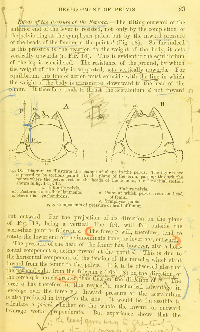 Ejects of the Pressure of the Femora.—The tilting outward of the anterior end of the lever is resisted, not only by the completion of the ipelvic ring at the symphysis j^ubis, but by the inward pressure of the heads of the femora at the jioint d (Fig. 18). So far indeed as this 2:>ressure is the reaction to the weight of the body, it acts vertically upwards (p, FlgTTs). This is evident if the equilibrium of the leg is considered. The resistance of the ground, by which' tlie weight of the body is supported, acts vertically in3ward3. For ec[uilibriimi tliis line of action must coincide with the liii^ in which the weight of the body is transmitted downward to the head of the ft'Tnur. It therefore tends to thrust the acetabulum d not inward Fig. 18.—Diagram to Ulustrate the change of shape iu^the pelvis. The figures are supposed to be sections parallel to the plane of the bi-im, passing through the sh!^^ iL fig 13 Vl^'^ ''''^'^ ° ^^^^^ °^ femora, like the actual section 7. T. i ■ I^^iitilc pelvis. B. Mature pelvis. f ^o^* ^J^i^li pelvis TBsts On bead c. baoro-iliac synchondrosis. of femur. e. Symphysis pubis, p, Q. Components of pressiu-e of head of femur. but outward. For the projection of its direction on the plane of Fig. 18, being a vertical line (p), wiU faU outside the sacro-ihac joint or fulcrum c. (The force p will, therefore, tend to rotate the lower end oJ the innominate bone, or lever ade, outward ■ The pressure of the head of the femur has, however, also a hoii zontal component q, acting inward at the point d. ' This is due to the horizontal component of the tension of the muscles which slant . n^vard from the femur to the. pelvis. It is to be observed also that the ppaftj^cular from the ^^}^}m^c(^^^) outhe direction, of the force Q IS muchvgreateiS. tl^ln ffiM'^dirfeon'^n^ (^^^- -fee i force Q has therefore in this respecf^a mechanical actvantlk in / leverage oyer the force p^ Inward pressm-e at the acetabulum / IS also produced m lynj^^n the side. It would be impossible to' calculate d ^^nm i^etlier on the whole the inward ir outward leverage woukyfreponderate. But experience shows that the ^ t Gwi;M \