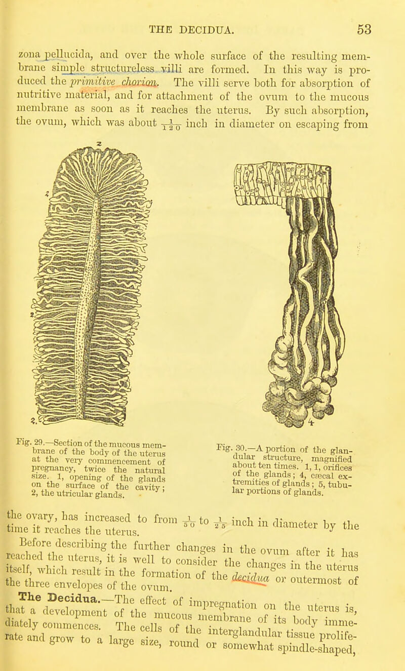 zona jDellucida, and over the whole surface of the resulting mem- brane siinglc structureless villi are formed. In this way is pro- duced the primitive choricoi. The villi serve both for absorption of nutritive material, and for attachment of the ovum to the mucous membrane as soon as it reaches the uterus. By such absorption, the ovum, which was about inch in diameter on escaping from Fig. 29.—Section of the mucous mem- brane of the body of the uterus at the very commencement of pregnancy, twice the natural size. 1, opening of the glands on the surface of the cavity; 2, the uti-icular glands. rig. ,30.—A portion of the glan- dular structure, magniiied about ten times. 1,1, oiifices of the glands; 4, crecal ex- tremities of glands ; 5, tubu- lar portions of glands. To to inch in diameter by the the ovary, has increased to from time it reaches the uterus. Before describing the further changes in the ovum nftpv i