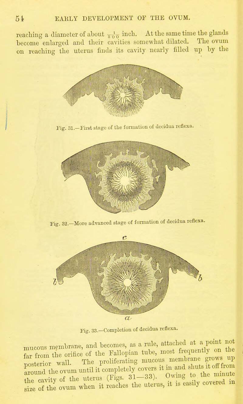 reacliing a diameter of about -g-^^-g inch. At the same time the glands become enlarged and their cavities somewhat dilated. The ovum on reaching the uterus finds its cavity nearly filled up by the Kg. 32—More advanced stage of foiuiation of decidua reflexa. Fig. 33.—Completion of decidua reflexa. nnicous membrane, and becomes, as a nile, attached at a point not