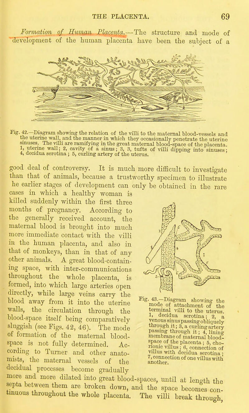 Formation of Human Placenta.—The structure and mode of 'tlevelopmerit of the human placenta have been the subject of a ^^>ff- 42.—Dia^am showing the relation of the villi to the maternal blood-vessels and the uteiine wall, and the manner in which they occasionally penetrate the uterine smuses; The villi are ramifying in the great maternal blood-space of the placenta. 1, utenne wall; 2, cavity of a sinus; 3, 3, tufts of villi dipping into sinuses; 4, decidua serptina ; 5, curling artery of the uterus, good deal of controversy. It is much more difficult to investigate than that of animals, because a trustworthy specimen to illustrate he earlier stages of development can only be obtained in the rare cases in which a healthy woman is killed suddenly within the first three months of pregnancy. According to the generally received account, the maternal blood is brought into much more immediate contact with the villi in the human placenta, and also in that of monkeys, than in that of any other animals. A great blood-contain- ing space, with inter-communications throughout the whole placenta, is formed, into which large arteries open directly, while large veins carry the blood away from it into the uterine walls, the circulation through the blood-space itself being comparatively sluggish (see Figs. 42, 46). The mode of formation of the maternal blood- space is not fully determined. Ac- cording to Turner and other anato- mists, the maternal vessels of the decidual processes become gradually more and more dilated into great blood-spaces, imtil at length the septa between them are broken down, and the space becomes con- tmuoua throughout the whole placenta. The viUi break through Fig. 43.—Diagram showing the mode of attachment of the terminal villi to the uterus. 1, decidua serotina; 2, a venous sinus passing obliquely through it; 3, a curling artery passmg through it; 4, lining membrane of maternal blood- space of the placenta; 5, cho- nomc vUlus ; 6, connection of villus with decidua serotina; 7, connection of one villus with another.