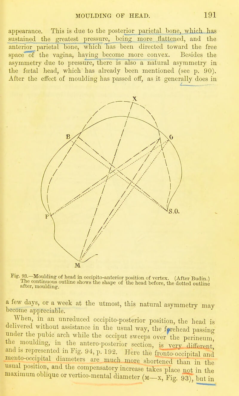 appearance. This is due to the j)osterior parietal bone, which ias siistaii^ed the greatest pressure, being more flattened, and the anterior parietal bone, which has been directed toward the free space of the vagina, haying become more convex. Besides the asymmetry due to j^ressure, there is also a natural asymmetry in tlie foetal head, which has already been mentioned (see p. 90). After the effect of moulding has passed off, as it generally does in ■^'^'rSv^^™^!'? of head in oecipito-anterior position of vertex. (After Budin 1 Ihe continuous outline shows the shape of the head before, the dotted outline after, moulding. a few days, or a week at the utmost, this natural asymmetry may become appreciable. When, in an unreduced occipito-posterior position, the head is delivered without assistance in the usual way, the f.rehead passing under the pubic arch while the occiput sweeps over the perineum the mouldmg, m the antero-posterior section, is very difl-erent' and IS represented in Fig. 94, p. 192. Here the frS'occipital and men o-occipital diameters are, much, more shortened than in the usual position, and the compensatory increase takes place not in the maximum oblique or vertico-mental diameter (m—x, Fia ^ but in