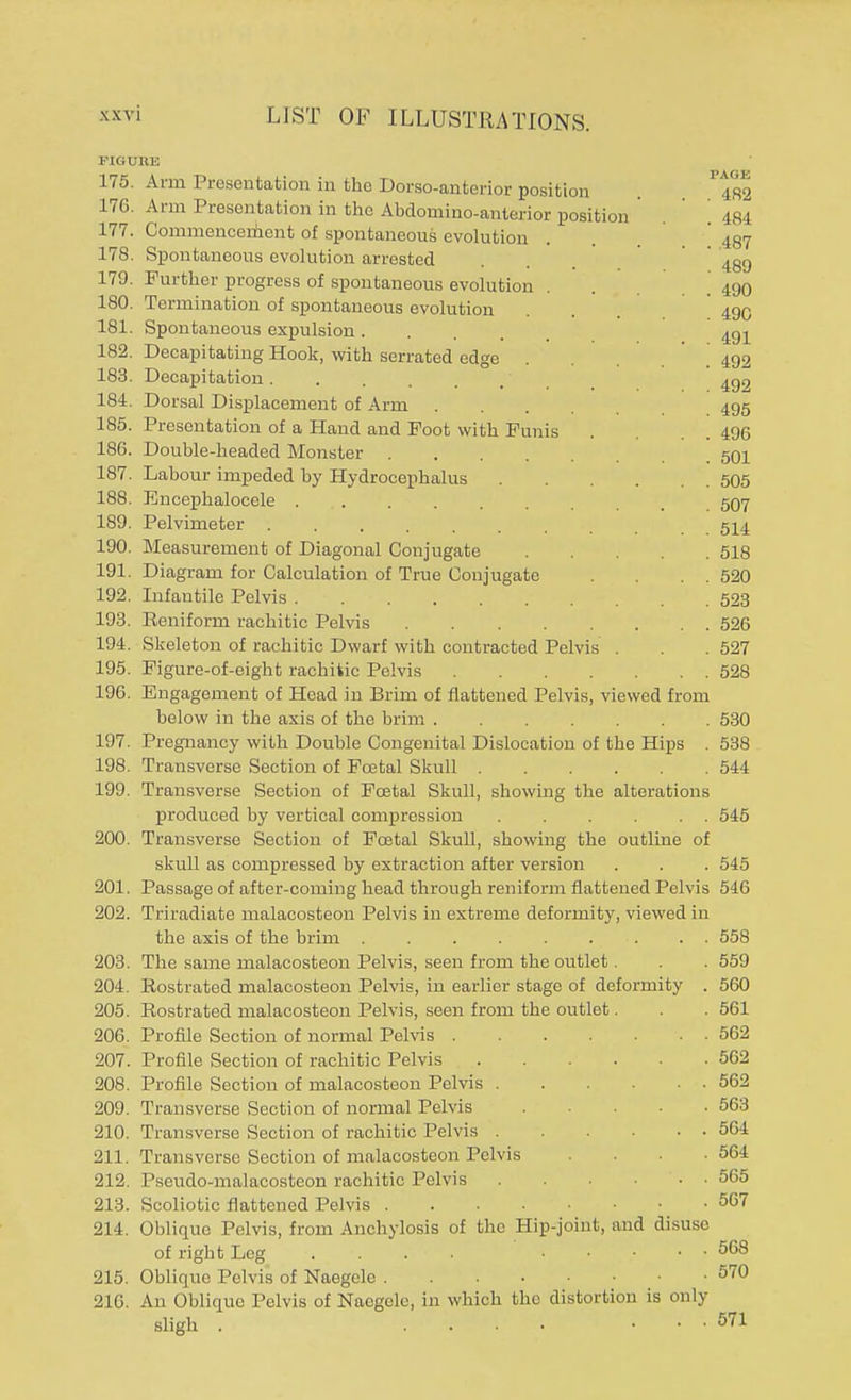 FIGURE 175. Arm Presentation in the Dorso-anterior position . 176. Arm Presentation in the Abdomino-anterior position 484 177. Commencement of spontaneous evolution . '437 178. Spontaneous evolution arrested . ' 4gg 179. Further progress of spontaneous evolution . \ 490 180. Termination of spontaneous evolution . . 49C 181. Spontaneous expulsion .... 491 182. Decapitating Hook, with serrated edge . . . ' [ 492 183. Decapitation 409 184. Dorsal Displacement of Arm 495 185. Presentation of a Hand and Foot with Funis . . 496 186. Double-headed Monster 501 187. Labour impeded by Hydrocephalus 505 188. Encephalocele 507 189. Pelvimeter 514 190. Measurement of Diagonal Conjugate . . 518 191. Diagram for Calculation of True Conjugate . . . 520 192. Infantile Pelvis 523 193. Reniform rachitic Pelvis 526 194. Skeleton of rachitic Dwarf with contracted Pelvis . . 527 195. Figure-of-eight rachitic Pelvis 528 196. Engagement of Head in Brim of flattened Pelvis, viewed from below in the axis of the brim 530 197. Pregnancy with Double Congenital Dislocation of the Hips . 538 198. Transverse Section of Fcetal Skull 544 199. Transverse Section of Fcetal Skull, showing the alterations produced by vertical compression 545 200. Transverse Section of Fcetal Skull, showing the outline of skull as compressed by extraction after version . . . 545 201. Passage of after-coming head through reniform flattened Pelvis 546 202. Triradiate malacosteon Pelvis in extreme deformity, viewed in the axis of the brim . . . . . . . . 558 203. The same malacosteon Pelvis, seen from the outlet. . . 559 204. Rostrated malacosteon Pelvis, in earlier stage of deformity . 560 205. Rostrated malacosteon Pelvis, seen from the outlet. . . 561 206. Profile Section of normal Pelvis 562 207. Profile Section of rachitic Pelvis 562 208. Profile Section of malacosteon Pelvis 562 209. Transverse Section of normal Pelvis . ■ • 563 210. Transverse Section of rachitic Pelvis . ... 564 211. Transverse Section of malacosteon Pelvis . . ■ 564 212. Pseudo-malacosteon rachitic Pelvis 565 213. Scoliotic flattened Pelvis • 567 214. Oblique Pelvis, from Anchylosis of the Hip-joint, and disuso of right Leg ... 568 215. Oblique Pelvis of Naegele 570 216. An Oblique Pelvis of Naegele, in which the distortion is only sligh . .... ... 571