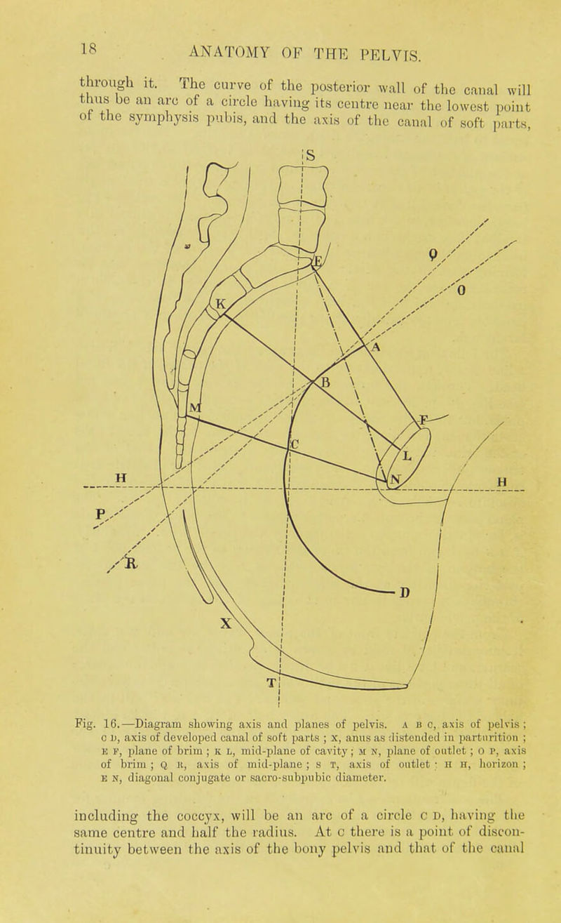 through it. The curve of the posterior wall of the canal will thus be an arc of a circle having its centre near the lowest point of the symphysis pubis, and the axis of the canal of soft pai ls Fig. 16.—Diagram showing axis and planes of pelvis. A b c, axis of pelvis; c u, axis of developed canal of soft parts ; x, anus as distended in parturition ; e k, plane of brim ; k l, mid-plane of cavity; M N, plane of outlet ; 0 P, axis of brim ; Q n, axis of mid-plane ; s t, axis of outlet • ii h, horizon ; n n, diagonal conjugate or sacro-subpubic diameter. including the coccyx, will be an arc of a circle c d, having the same centre and half the radius. At o there is a poinl <>t' discon- tinuity between the axis of the bony pelvis and that of the canal