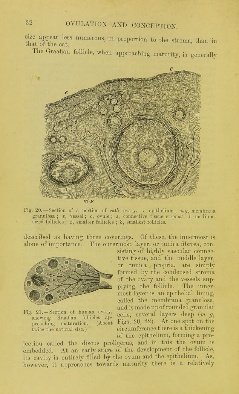 size that OVULATION AND CONCEPTION. » appear less numerous, in proportion to the stroma, than in at of the cat. The Graafian follicle, when approaching maturity, is generally Fig. 20.—Section of a portion of cat's ovary, e, epithelium ; rag, membrana granulosa ; v, vessel; o, ovule ; s, connective tissue stroma'; 1, medium- sized follicles ; 2, smaller follicles ; 3, smallest follicles. described as having three coverings. Of these, the innermost is alone of importance. The outermost layer, or tunica fibrosa, con- sisting of highly vascular connec- tive tissue, and the middle layer, or tunica propria, are simply formed by the condensed stroma of the ovary and the vessels sup- plying the follicle. The inner- most layer is an epithelial lining, called the membrana granulosa, and is made upof rounded granular cells, several layers deep (m g, (About Figs. 20, 22). At one spot on the circumference there is a thickening of the epithelium, forming a pro- jection called the discus proligerus, and in this the ovum is embedded. At an early stage of the development of the follicle, its cavity is entirely filled by the ovum and the epithelium. As, however, it approaches towards maturity there is a relatively Fig. 21. —Section of human ovary, showing Graafian follicles ap- proa ohi n g matu ration, twice the natural size.)