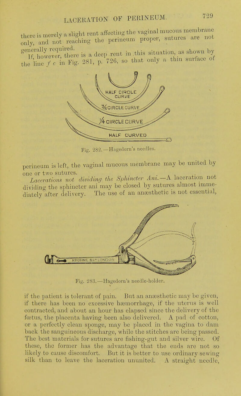 there is merely a slight rent affecting the vaginal mucous membrane X anTS reaching the perineum proper, sutures are not gT&vet^L is a deep rent in this situation as shown by the line /•<• to Fig. 281, p. 726, so that only a thin surface of Fig. 282.— Hagedorn's needles. perineum is left, the vaginal mucous membrane may be united by one or two sutures. Lacerations not dividing the Sphincter Am. —A laceration not dividing the sphincter ani may be closed by sutures almost imme- diately after delivery. The use of an anaesthetic is not essential, Fig. 283.—Hagedorn's needle-holder. if the patient is tolerant of pain. But an anaesthetic may be given, if there has been no excessive haemorrhage, if the uterus is well contracted, and about an hour has elapsed since the delivery of the foetus, the placenta having been also delivered. A pad of cotton, or a perfectly clean sponge, may be placed in the vagina to dam back the sanguineous discharge, while the stitches arc being passed. The best materials for sutures are fishing-gut and silver wire. (>f these, the former has the advantage that the ends are not so likely to cause discomfort. But it is better to use ordinary sewing silk than to leave the laceration ununited. A straight needle,