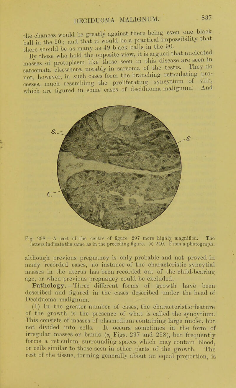 the chances would be greatly against there being even one black ball in the 90; and that it would be a practical impossibility that there should be as many as 49 black balls in the 90 By those who hold the opposite view, it is argued that nucleated masses of protoplasm like those seen in this disease are seen m sarcomata elsewhere, notably in sarcoma of the testis, lney do not however, in such cases form the branching reticulating pro- cesses, much resembling the proliferating syncytium of villi, which are figured in some cases of deciduoma mahgnum. And Fig. 298.—A part of the centre of figure 297 more highly magnified. The letters indicate the same as in the preceding figure. X 240. From a photograph. although previous pregnancy is only probable and not proved in many recorded cases, no instance of the characteristic syncj'tial masses in the uterus has been recorded out of the child-bearing age, or when previous pregnancy could be excluded. Pathology.—Three different forms of growth have been described and figured in the cases described under the head of Deciduoma malignum. (1) In the greater number of cases, the characteristic feature of the growth is the presence of what is called the syncytium. This consists of masses of plasmodmm containing large nuclei, but not divided into cells. It occurs sometimes in the form of irregular masses or bands (s, Figs. 297 and 298), but frequently forms a reticulum, surrounding spaces which may contain blood, or cells similar to those seen in other parts of the growth. The rest of the tissue, forming generally about an equal proportion, is