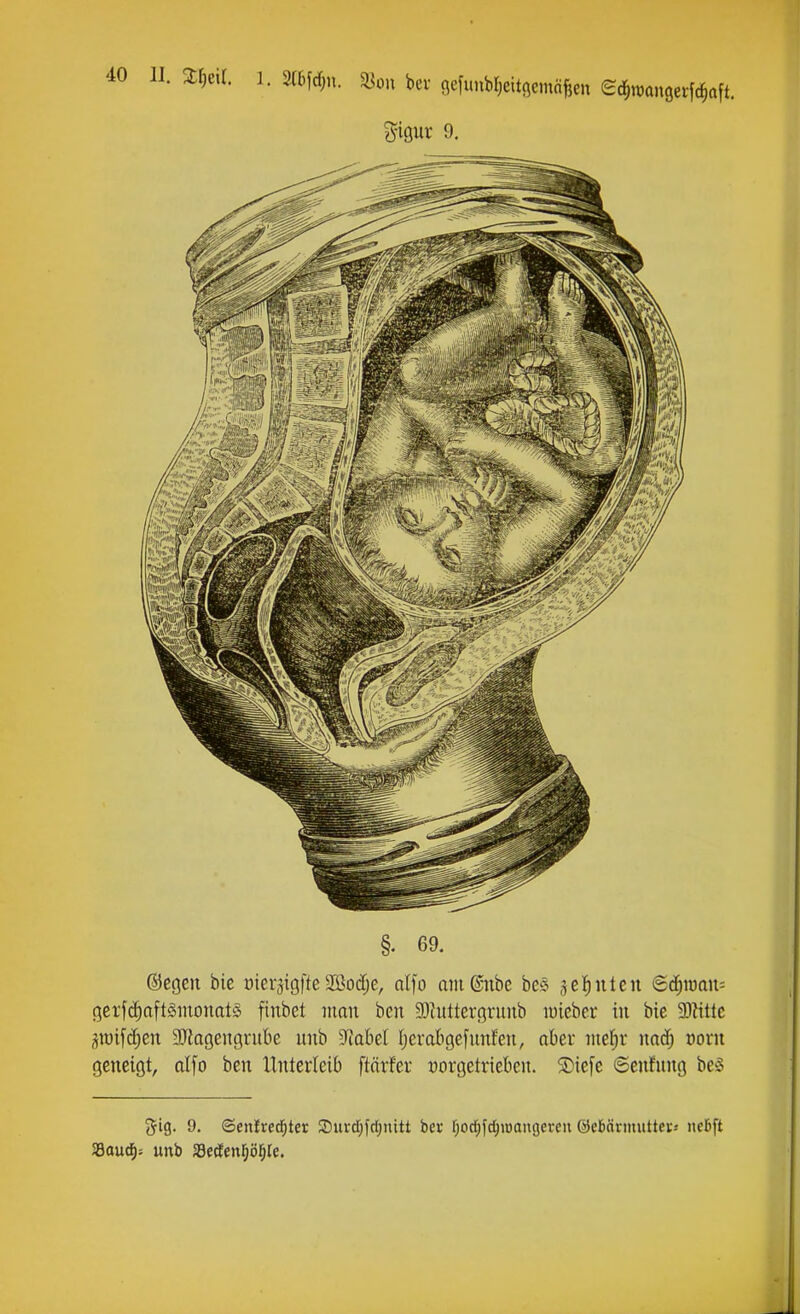 II. 2:§eil. 1. 2(Mrf;n. ^on bei- ßefunbljeitöcmä^en Sc^roangcifclaft. gipr 9. §. 69. ©egeit bie oierjigfte Söodjc, dfo am(Snbc beS ^eJinlcn €(^iüau= gerf^ttftSinonatS finbet man ben SDhttterßruub luicber in bic 9)itttc jtt)if(^en SJflagenqrnbe unb ?{abel Jjerdigefnnfen, aber niefir nad) t)orn geneigt, alfo ben Xlnterleib ftärfev uovgetrieben. ®iefe 6cn!nng be§ 5ig. 9. ©enlred^ter 2)uvcr;fcl)nitt her fjoc^fdjioangeveu ©ebärmuttci;.- nebft Saud): unb S3eöenrjör;Ie,