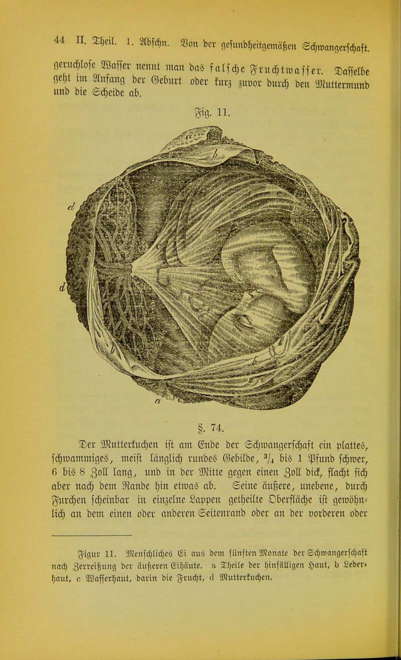 öerudMcJffiaffer nennt man ba^s fat|rf;c Srnd;t«)affer. 3)affeIBc öe^t im Slnfang ber ©ebnrt ober fura p.or bnrd; ben 3)luttennunb unb bie ©d^eibe ab. m 11. §. 74. 3)er 9Jtutterfud)en ift am ©nbe ber ©d;iüauger[(^aft ein ptatlee, f(^n)ammtge§, meift länglid; runbe§ ©ebilbe, bi§ 1 ^funb fd;roer, 6 bis 8 QotL lang, unb in ber 2)iitte gegen einen Qo\l hiä, fladjt fidj ober na^ bem 9tanbe I)in etmaS ab. ©eine ändere, unebene, burd) %ux^zn fd)einbar in einjelne Sappen getl^eilte Dberfläc^e ift geioöfin^ Ii(^ an bem einen ober anbereu ©eitenranb ober an ber vorbercn ober g^igur 11. 3JJenfct)üdjcö ®i auä bem fünften 9Konate bcv edjinangei-fd^aft nad) ^erreifiung bev üitfjeren (Sifjäute. a 2:r)ei[e ber r^infältigcn <^mi, h Seber» l^aut, c aßafferfjaut, bann bie gvucf)t, d aJhitterfud^en.