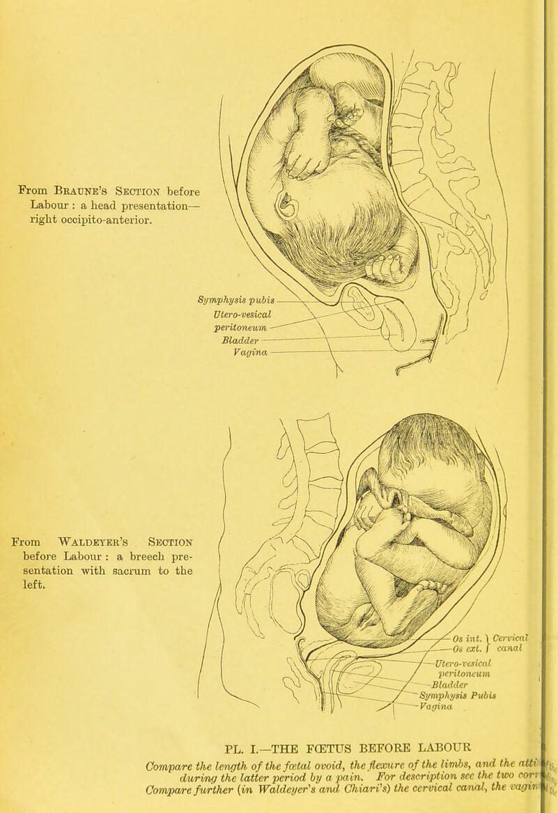 PL. I.—THE FCETUS BEFORE LABOUR Compare the length of the fcetal ovoid-, the.flexure of the limbs, and the atti during the latter period by a pain. For description sec the two cor; Compare further (in Waldeyer's and Chiari's) the cervical canal, the vagin \,