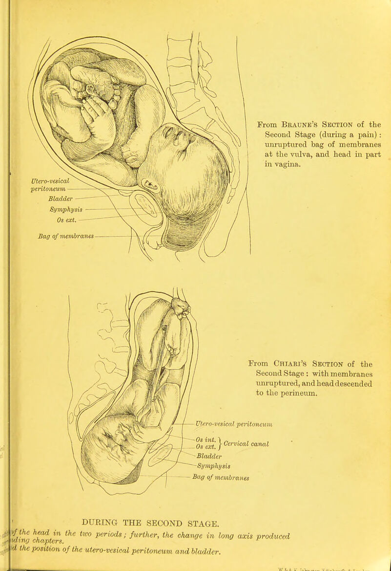 DURING THE SECOND STAGE. I the head in the two periods; further, the change in long axis produced f Ming chapters. d the position of the utero-vesical peritoneum and bladder.