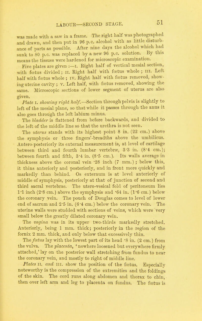 was made with a saw in a frame. The right half was photographed and drawn, and then put in 96 p.c. alcohol with as little disturb- ance of parts as possible. After nine days the alcohol which had sunk to 80 p.c. was replaced by a new 96 p.c. solution. ^ By this means the tissues were hardened for microscopic examination. Five plates are given :—I. Right half of vertical mesial section, with foetus divided; n. Right half with fcetus whole ; hi. Left half with foetus whole ; iv. Right half with foetus removed, show- ing uterine cavity ; v. Left half, with fcetus removed, showing the same. Microscopic sections of lower segment of uterus are also given. Plate i. showing right half.— Section through pelvis is slightly to left of the mesial plane, so that while it passes through the anus it also goes through the left labium minus. The bladder is flattened from before backwards, and divided to the left of the middle line so that the urethra is not seen. The uterus stands with its highest point 8 in. (22 cm.) above the symphysis or three fingers'-breadths above the umbilicus. Antero-posteriorly its external measurement is, at level of cartilage between third and fourth lumbar vertebrae, 33 iu. (8*4 cm.); between fourth and fifth, 3-4 in. (8-5 cm.). Its walls average in thickness above the coronal vein -28 inch (7 mm.); below this, it thins anteriorly and posteriorly, and in front more quickly and markedly than behind. Os externum is at level anteriorly of middle of symphysis, posteriorly at that of junction of second and third sacral vertebrae. The utero-vesical fold of peritoneum lies l'l inch (2'8 cm.) above the symphysis and 64 in. (1*6 cm.) below the coronary vein. The pouch of Douglas comes to level of lower end of sacrum and 25 in. (64 cm.) below the coronary vein. The uterine walls were studded with sections of veins, which were very small below the greatly dilated coronary vein. The vagina was in its upper two-thirds markedly stretched. Anteriorly, being 1 mm. thick; posteriorly in the region of the fornix 2 mm. thick, and only below that excessively thin. The fostus lay with the lowest part of its head *8 in. (2 cm.) from the vulva. The placenta, ' nowhere loosened but everywhere firmly attached,' lay on the posterior wall stretching from fundus to near the coronary vein, and mostly to right of middle line. Plates ii. and in. show the position of the foetus. Especially noteworthy is the compression of the extremities and the foldings of the skin. The cord runs along abdomen and thorax to chin, then over left arm and leg to placenta on fundus. The fcetus is