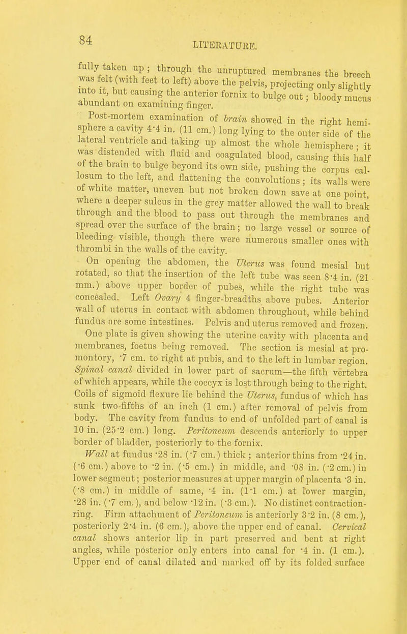 LITERATURE. fully takeu up ; through the unruptured membranes the breech was elt (with feet to left) above the pelvis, projecting only slightly into it, but causing the anterior fornix to bulge out; bloody mucus abundant on examining finger. Post-mortem examination of brain showed in the ri-ht hemi sphere a cavity 4'4 in. (11 cm.) long lying to the outer side of the lateral ventricle and taking up almost the whole hemisphere • it was distended with fluid and coagulated blood, causing this half ot the bram to bulge beyond its own side, pushing the corpus cab losum to the left, and flattening the convolutions; its walls were of white matter, uneven but not broken down save at one point where a deeper sulcus in the grey matter allowed the wall to break through and the blood to pass out through the membranes and spread over the surface of the brain; no large vessel or source of bleeding visible, though there were numerous smaller ones with thrombi in the walls of the cavity. On opening the abdomen, the Uterus was found mesial but rotated, so that the insertion of the left tube was seen 8-4 in. (21 mm.) above upper border of pubes, while the right tube was concealed. Left Ovary 4 finger-breadths above pubes. Anterior wall of uterus in contact with abdomen throughout, while behind fundus nre some intestines. Pelvis and uterus removed and frozen. One plate is given showing the uterine cavity with placenta and membranes, foetus being removed. The section is mesial at pro- montory, 7 cm. to right at pubis, and to the left in lumbar region. Spinal canal divided in lower part of sacrum—the fifth vertebra of which appears, while the coccyx is lost through being to the right. Coils of sigmoid flexure lie behind the Uterus, fundus of which has sunk two-fifths of an inch (1 cm.) alter removal of pelvis from body. The cavity from fundus to end of unfolded part of canal is 10 in. (25-2 cm.) long. Peritoneum descends anteriorly to upper border of bladder, posteriorly to the fornix. Wall at fundus -28 in. (7 cm.) thick ; anterior thins from -24 in. ('6 cm.) above to -2 in. (-5 cm.) in middle, and -0S in. (-2 cm.) in lower segment; posterior measures at upper margin of placenta -3 in. (8 cm.) in middle of same, '4 in. (1-1 cm.) at lower margin, •28 in. (7 cm.), and below '12 in. (3 cm.). No distinct contraction- ring. Firm attachment of Peritoneum is anteriorly 32 in. (8 cm.), posteriorly 2'4 in. (6 cm.), above the upper end of canal. Cervical canal shows anterior lip in part preserved and bent at right angles, while posterior only enters into canal for '4 in. (1 cm.). Upper end of canal dilated and marked off by its folded surface