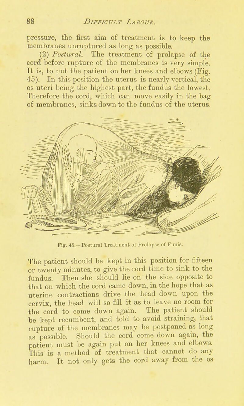 pressure, the first aim of treatment is to keep the membranes i;nruptured as long as possible. (2) Postural. The treatment of prolapse of the cord before rupture of the membranes is very simple. It is, to put the patient on her knees and elbows (Fig. 45). In this position the uterus is nearly vertical, the OS uteri being the highest part, the fundus the lowest. Therefore the cord, which can move easily in the bag of membranes, sinks down to the fundus of the uterus. f^g. 45.—Postural Treatment of Prolapse of Funis. The patient should be kept in this position for fifteen or twenty minutes, to give the cord time to sink to the fundus. Then she should lie on the side opposite to that on which the cord came down, in the hope that as uterine contractions drive the head down upon the cervix, the head will so fill it as to leave no room for the cord to come down again. The patient should be kept recumbent, and told to avoid straining, that rupture of the membranes may be postponed as long as possible. Should the cord come down again, the patient must be again put on her knees and elbows. This is a metliod of treatment that cannot do any barm. It not only gets the cord away from the os