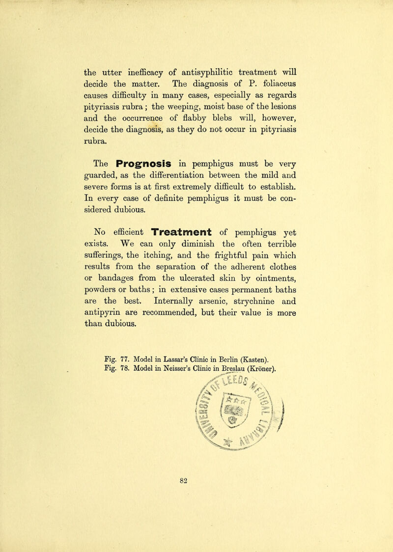 the utter inefficacy of antisyphilitic treatment will decide the matter. The diagnosis of P. foliaceus causes difficulty in many cases, especially as regards pityriasis rubra ; the weeping, moist base of the lesions and the occurrence of flabby blebs will, however, decide the diagnosis, as they do not occur in pityriasis rubra. The ProgfnoSiS in pemphigus must be very guarded, as the differentiation between the mild and severe forms is at first extremely difficult to establish. In every case of definite pemphigus it must be con- sidered dubious. No efficient TrCcltment of pemphigus yet exists. We can only diminish the often terrible sufferings, the itching, and the frightful pain which results from the separation of the adherent clothes or bandages from the ulcerated skin by ointments, powders or baths ; in extensive cases permanent baths are the best. Internally arsenic, strychnine and antipyrin are recommended, but their value is more than dubious. Fig. 77. Model in Lassar's Clinic in Berlin (Kasten). Fig. 78. Model in Neisser's Clinic in Breslau (Kroner).