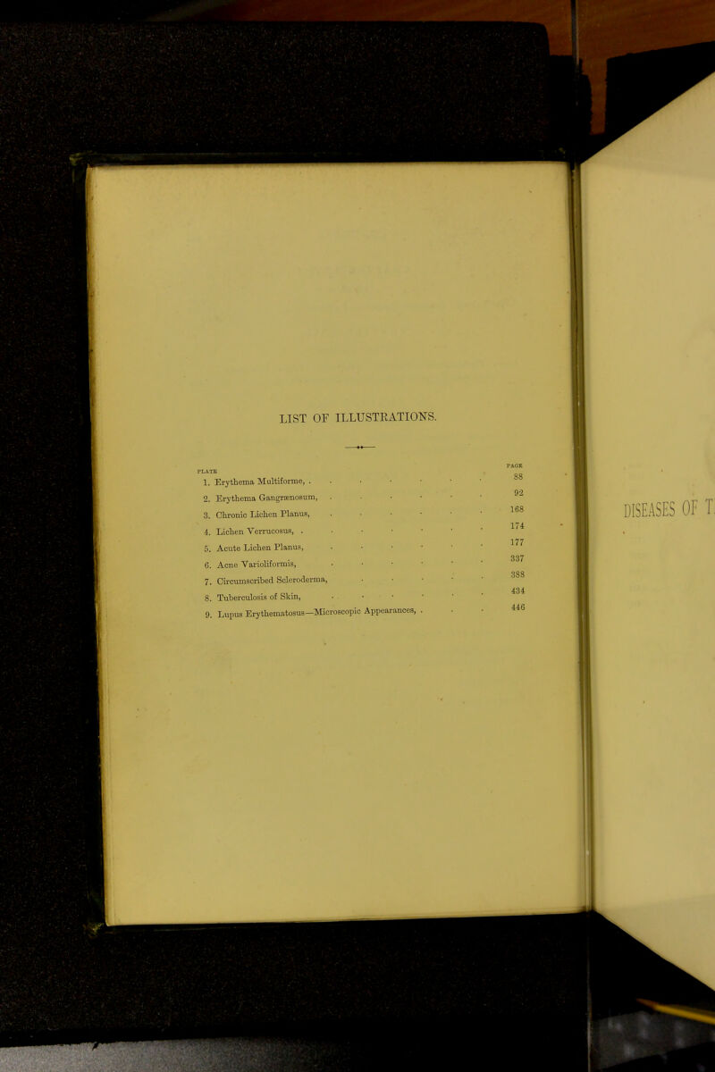 LIST OF ILLUSTEATIOKS. PLATE 1. Erythema Multiforme, . 2. Erythema Gangrenosum, 3. Chronic Lichen Planus, 4. Lichen Verrucosus, . 5. Acute Lichen Planus, 6. Acne Varioliformis, 7. Circumscribed Scleroderma, 8. Tuberculosis of Skin, 9. Lupus Erythematosus—Microscopic Appearances, PAGE 88 92 168 174 177 337 388 434 446