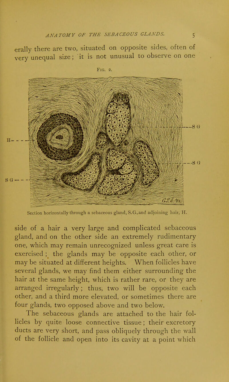 erally there are two, situated on opposite sides, often of very unequal size; it is not unusual to observe on one Fig. 2. Section horizontally through a sebaceous gland, S.G.and adjoining hair, H. side of a hair a very large and complicated sebaceous gland, and on the other side an extremely rudimentary one, which may remain unrecognized unless great care is exercised ; the glands may be opposite each other, or may be situated at different heights. When follicles have several glands, we may find them either surrounding the hair at the same height, which is rather rare, or they are arranged irregularly; thus, two will be opposite each other, and a third more elevated, or sometimes there are four glands, two opposed above and two below. The sebaceous glands are attached to the hair fol- licles by quite loose connective tissue; their excretory ducts are very short, and pass obliquely through the. wall of the follicle and open into its cavity at a point which