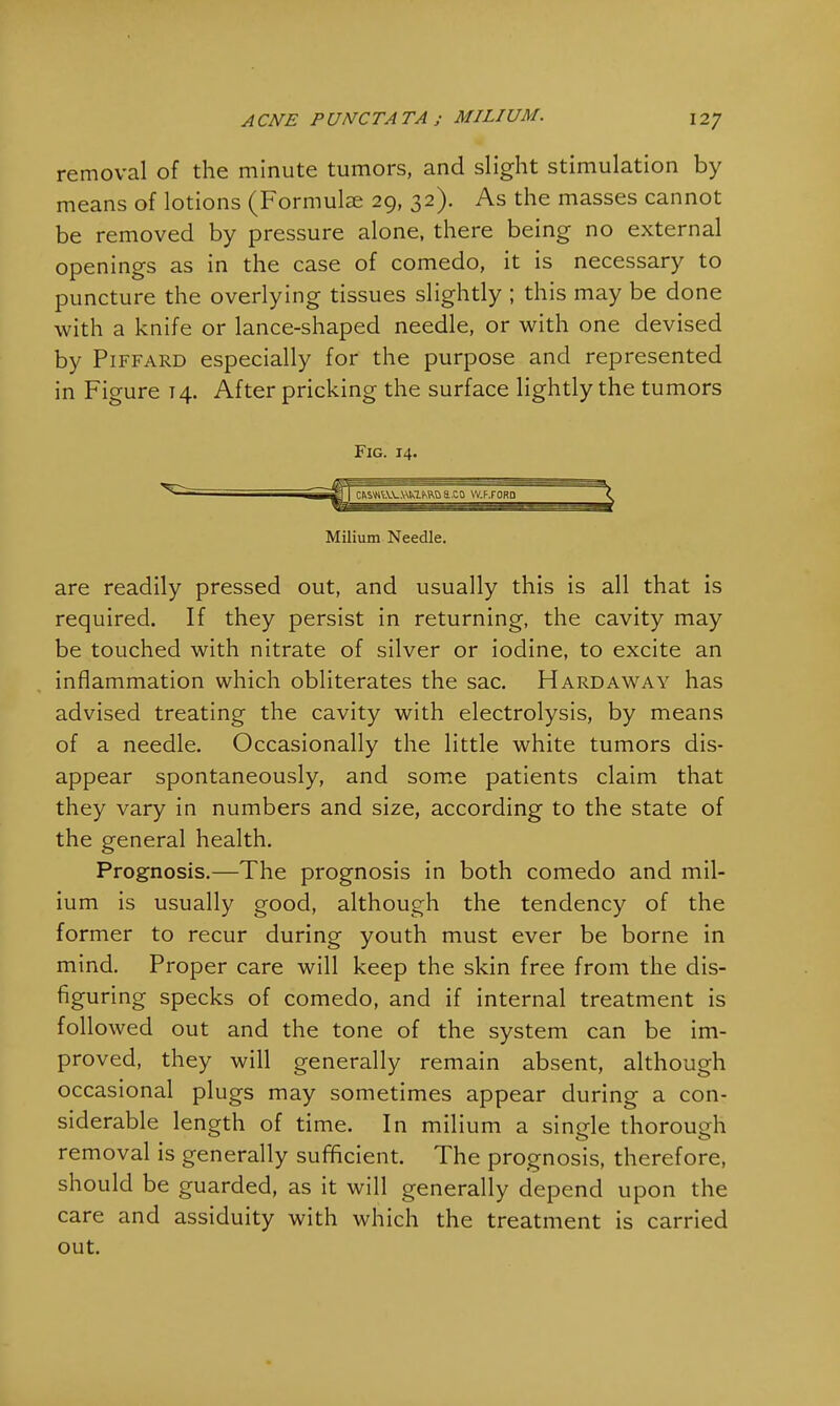removal of the minute tumors, and slight stimulation by means of lotions (Formulae 29, 32). As the masses cannot be removed by pressure alone, there being no external openings as in the case of comedo, it is necessary to puncture the overlying tissues slightly ; this may be done with a knife or lance-shaped needle, or with one devised by Piffard especially for the purpose and represented in Figure T4. After pricking the surface lightly the tumors Fig. 14. Milium Needle. are readily pressed out, and usually this is all that is required. If they persist in returning, the cavity may be touched with nitrate of silver or iodine, to excite an inflammation which obliterates the sac. Hard away has advised treating the cavity with electrolysis, by means of a needle. Occasionally the little white tumors dis- appear spontaneously, and some patients claim that they vary in numbers and size, according to the state of the general health. Prognosis.—The prognosis in both comedo and mil- ium is usually good, although the tendency of the former to recur during youth must ever be borne in mind. Proper care will keep the skin free from the dis- figuring specks of comedo, and if internal treatment is followed out and the tone of the system can be im- proved, they will generally remain absent, although occasional plugs may sometimes appear during a con- siderable length of time. In milium a single thorough removal is generally sufficient. The prognosis, therefore, should be guarded, as it will generally depend upon the care and assiduity with which the treatment is carried out.