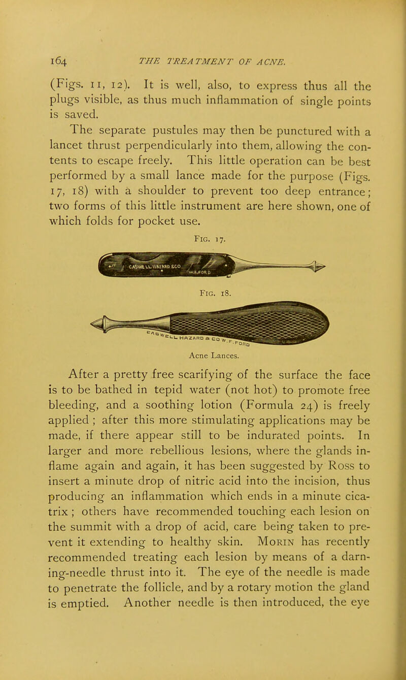 (Figs. 11, 12). It is well, also, to express thus all the plugs visible, as thus much inflammation of single points is saved. The separate pustules may then be punctured with a lancet thrust perpendicularly into them, allowing the con- tents to escape freely. This little operation can be best performed by a small lance made for the purpose (Figs. 17, 18) with a shoulder to prevent too deep entrance; two forms of this little instrument are here shown, one of which folds for pocket use. Fig. 17. Acne Lances. After a pretty free scarifying of the surface the face is to be bathed in tepid water (not hot) to promote free bleeding, and a soothing lotion (Formula 24) is freely applied ; after this more stimulating applications may be made, if there appear still to be indurated points. In larger and more rebellious lesions, where the glands m. flame again and again, it has been suggested by Ross to insert a minute drop of nitric acid into the incision, thus producing an inflammation which ends in a minute cica- trix ; others have recommended touching each lesion on the summit with a drop of acid, care being taken to pre- vent it extending to healthy skin. Morin has recently recommended treating each lesion by means of a darn- ing-needle thrust into it. The eye of the needle is made to penetrate the follicle, and by a rotary motion the gland is emptied. Another needle is then introduced, the eye