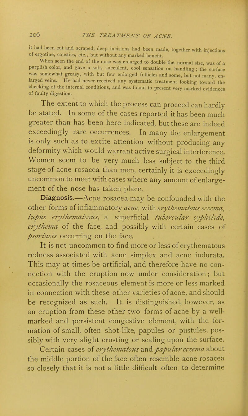 it had been cut and scraped, deep incisions had been made, together with injections of ergotine, caustics, etc., but without any marked benefit. When seen the end of the nose was enlarged to double the normal size, was of a purplish color, and gave a soft, succulent, cool sensation on handling ; the surface was somewhat greasy, with but few enlarged follicles and some, but not many, en- larged veins. He had never received any systematic treatment looking toward the checking of the internal conditions, and was found to present very marked evidences of faulty digestion. The extent to which the process can proceed can hardly be stated. In some of the cases reported it has been much greater than has been here indicated, but these are indeed exceedingly rare occurrences. In many the enlargement is only such as to excite attention without producing any deformity which would warrant active surgical interference. Women seem to be very much less subject to the third stage of acne rosacea than men, certainly it is exceedingly uncommon to meet with cases where any amount of enlarge- ment of the nose has taken place. Diagnosis.—Acne rosacea may be confounded with the other forms of inflammatory acne, with erythematous eczema, lupus erythematosus, a superficial tubercular syphilide, erythema of the face, and possibly with certain cases of psoriasis occurring on the face. It is not uncommon to find more or less of erythematous redness associated with acne simplex and acne indurata. This may at times be artificial, and therefore have no con- nection with the eruption now under consideration; but occasionally the rosaceous element is more or less marked in connection with these other varieties of acne, and should be recognized as such. It is distinguished, however, as an eruption from these other two forms of acne by a well- marked and persistent congestive element, with the for- mation of small, often shot-like, papules or pustules, pos- sibly with very slight crusting or scaling upon the surface. Certain cases of erythematousand papular eczema about the middle portion of the face often resemble acne rosacea so closely that it is not a little difficult often to determine