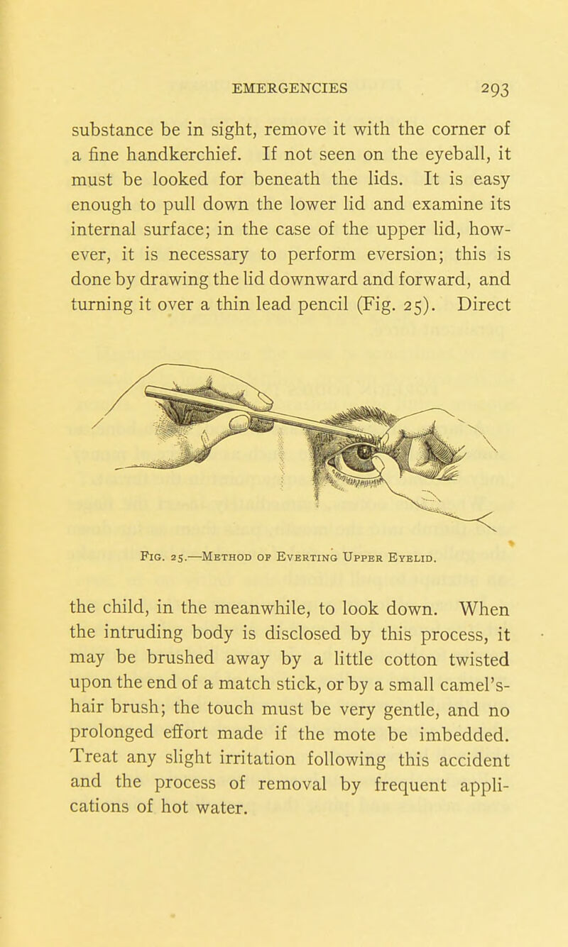 substance be in sight, remove it with the corner of a fine handkerchief. If not seen on the eyeball, it must be looked for beneath the lids. It is easy enough to pull down the lower lid and examine its internal surface; in the case of the upper lid, how- ever, it is necessary to perform eversion; this is done by drawing the lid downward and forward, and turning it over a thin lead pencil (Fig. 25). Direct > Fig. 25.—Method op Everting Upper Eyelid. the child, in the meanwhile, to look down. When the intruding body is disclosed by this process, it may be brushed away by a little cotton twisted upon the end of a match stick, or by a small camel's- hair brush; the touch must be very gentle, and no prolonged effort made if the mote be imbedded. Treat any slight irritation following this accident and the process of removal by frequent appli- cations of hot water.