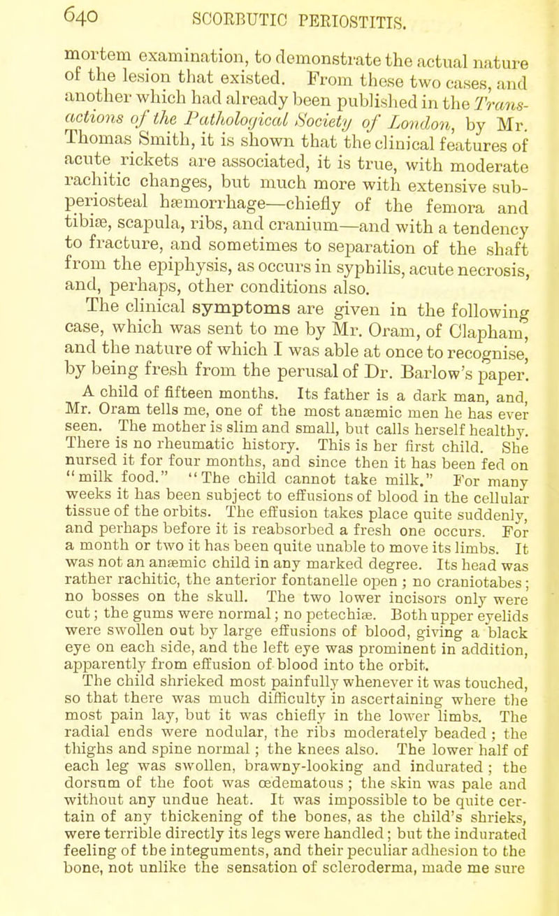 mortem examination, to demonstrate the actual nature of the lesion that existed. From these two cases, and another which had already been published in the Trans- actions of the Pathologicat Society of London, by Mr. Thomas Smith, it is shown that the clinical features of acute rickets are associated, it is true, with moderate rachitic changes, but much more with extensive sub- periosteal haemorrhage—chiefly of the femora and tibiaj, scapula, ribs, and cranium—and with a tendency to fracture, and sometimes to separation of the shaft from the epiphysis, as occurs in syphilis, acute necrosis, and, perhaps, other conditions also. The clinical symptoms are given in the following case, which was sent to me by Mr. Oram, of Olapham, and the nature of which I was able at once to recognise, by being fresh from the perusal of Dr. Barlow's paper! A child of fifteen months. Its father is a dark man, and, Mr. Oram tells me, one of the most anaemic men he has ever seen. The mother is slim and small, but calls herself healthy. There is no rheumatic history. This is her first child. She nursed it for four months, and since then it has been fed on milk food.  The child cannot take milk. For many weeks it has been subject to effusions of blood in the cellular tissue of the orbits. The effusion takes place quite suddenly, and perhaps before it is reabsorbed a fresh one occurs. For a month or two it has been quite unable to move its limbs. It was not an anaemic child in any marked degree. Its head was rather rachitic, the anterior f ontanelle open ; no craniotabes; no bosses on the skull. The two lower incisors only were cut; the gums were normal; no petechise. Both upper eyelids were swollen out by large effusions of blood, giving a black eye on each side, and the left eye was prominent in addition, apparently from effusion of blood into the orbit. The child shrieked most painfully whenever it was touched, so that there was much difficulty in ascertaining where the most pain lay, but it was chiefly in the lower limbs. The radial ends were nodular, the ribs moderately beaded ; the thighs and spine normal; the knees also. The lower half of each leg was swollen, brawny-looking and indurated ; the dorsum of the foot was cedematous ; the skin was pale and without any undue heat. It was impossible to be quite cer- tain of any thickening of the bones, as the child's shrieks, were terrible directly its legs were handled; but the indurated feeling of the integuments, and their peculiar adhesion to the bone, not unlike the sensation of scleroderma, made me sure