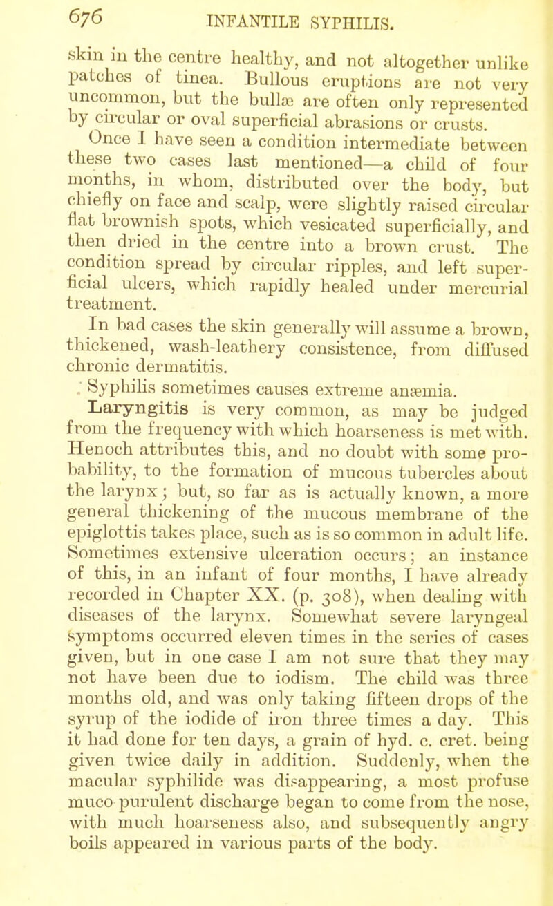 skin m the centre healthy, and not altogether unlike patches of tinea. Bullous eruptions are not very uncommon, but the bullae are often only represented by cii'cular or oval superficial abrasions or crusts. Once 1 have seen a condition intermediate between these two cases last mentioned—a child of four months, in whom, distributed over the body, but chiefly on face and sculp, were slightly raised circular flat brownish spots, which vesicated superficially, and then dried in the centre into a brown crust. The condition spread by circular ripples, and left super- ficial ulcers, which rapidly healed under mercurial treatment. In bad cases the skin generally will assume a brown, thickened, wash-leathery consistence, from difiused chronic dermatitis. . Syphilis sometimes causes extreme anaemia. Laryngitis is very common, as may be judged from the frequency with which hoarseness is met with. Henoch attributes this, and no doubt with some pro- bability, to the formation of mucous tubercles about the larynx; but, so far as is actually known, a more general thickening of the mucous membrane of the epiglottis takes place, such as is so common in adult life. Sometimes extensive ulceration occurs; an instance of this, in an infant of four months, I have already recorded in Chapter XX. (p. 308), when dealing with diseases of the larynx. Somewhat severe laryngeal symptoms occurred eleven times in the series of cases given, but in one case I am not sure that they may not have been due to iodism. The child was three months old, and was only taking fifteen drops of the syrup of the iodide of iron three times a day. This it had done for ten daj's, a grain of hyd. c. cret. being given twice daily in addition. Suddenly, when the macular syphilide was dii^a^apearing, a most profuse muco piu'ulent discharge began to come from the nose, with much hoarseness also, and subsequently angry boils appeared in various parts of the body.