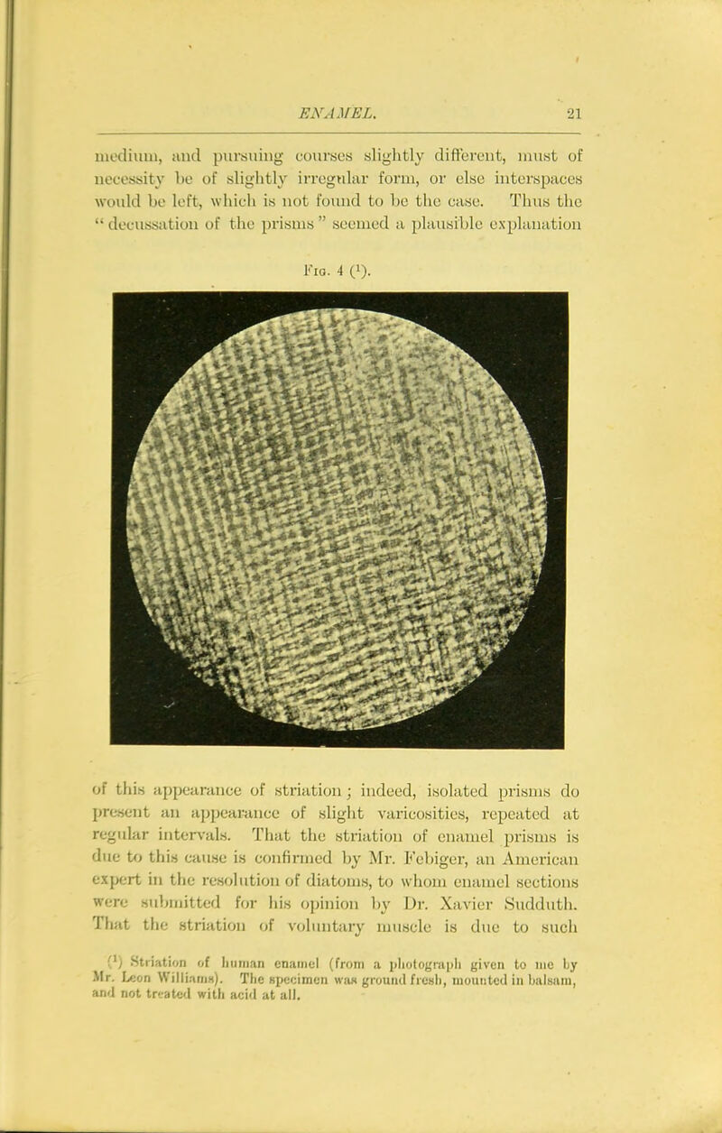 inedium, and pursuing courses slightly different, must of necessity be of slightly irregular form, or else interspaces would be left, which is not found to be the case. Thus the  decussation of the prisms  seemed a plausible explanation Kio. 4 (1). of this appearance of striatiou; indeed, isolated prisms do jjresent an appearance of slight varicosities, repeated at regular intcr\'als. That the striation of enamel prisms is due to this cause is confirmed by Mr. Febiger, an American expert in the resolution of diatoms, to whom enamel sections were sul^mitted for his opinion l)y Dr. Xavier Sudduth. That the striation of voluntary muscle is due to such (') Striation of linman enamel (from a pliotograph given to iiic by Mr. Leon Willi.-ims). Tlie specimen wa« ground fresli, mounted in balsam, and not treated wilb acid at ail.