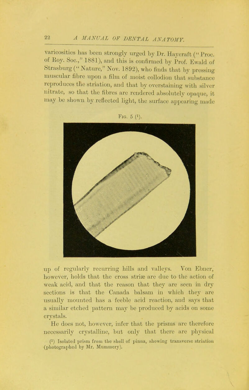 varicosities has been strongly urged l)y \)y. Hayeraft ( I'roc. of lioy. Soc., 1881), and tliis is confirmed Ijy Prof. Ewald of StrasburgC Nature, Nov. 1892), who finds that by pressing nuiscnlar filjrc upon a film of moist collodion that substance reproduces the striation, and that l)y overstaining witli silver nitrate, so that the fibres are rendered absolutely opaque, it may be shown by reflected light, the surface appearing njade Fig. 5 (i). lip of regularly recurring hills and valle\'S. Von Ebner, however, holds that the cross striae are due to the action of weak acid, and that the reason that they are seen in dry sections is that the Canada balsam in which they are usually mounted has a feeble acid reaction, and says that a similar etched pattern may be produced by acids on some ciystals. He does not, however, infer that the prisms are therefore necessarily crystalline, but only that there are physical (1) IsoIiUod prism from llic .shell of pinna, .showing tiuusverse striation (photographed by Mr. ]\tunimery).