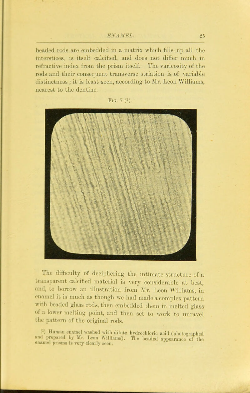 beaded rods are embedded in a matrix wliicli fills up all the interstices, is itself calcified, and does not difier much in refmctive index from the prism itself. The varicosity of the rods and their consequent transverse striation is of variable distinctness ; it is least seen, according' to Mr. Leon Williams, nearest to the dentine. Fio. 7 (1). The difficulty of deciphering tlie intimate structure of a transparent calcified material is very considerable at best, and, to borrow an illustration from Mr. Leon Williams, in enamel it is much as though we had made a complex pattern with beaded glass rodd, then embedded them in melted glass of a lower melting point, and then set to work to unravel the pattern of the original rods. (>) Human enamel washed with dilute liydrochloric acid (photographed nn.\ i,rei«ired by Mr. Leon Williams). The headed appearance of the enamel prisms is very clearly seen.