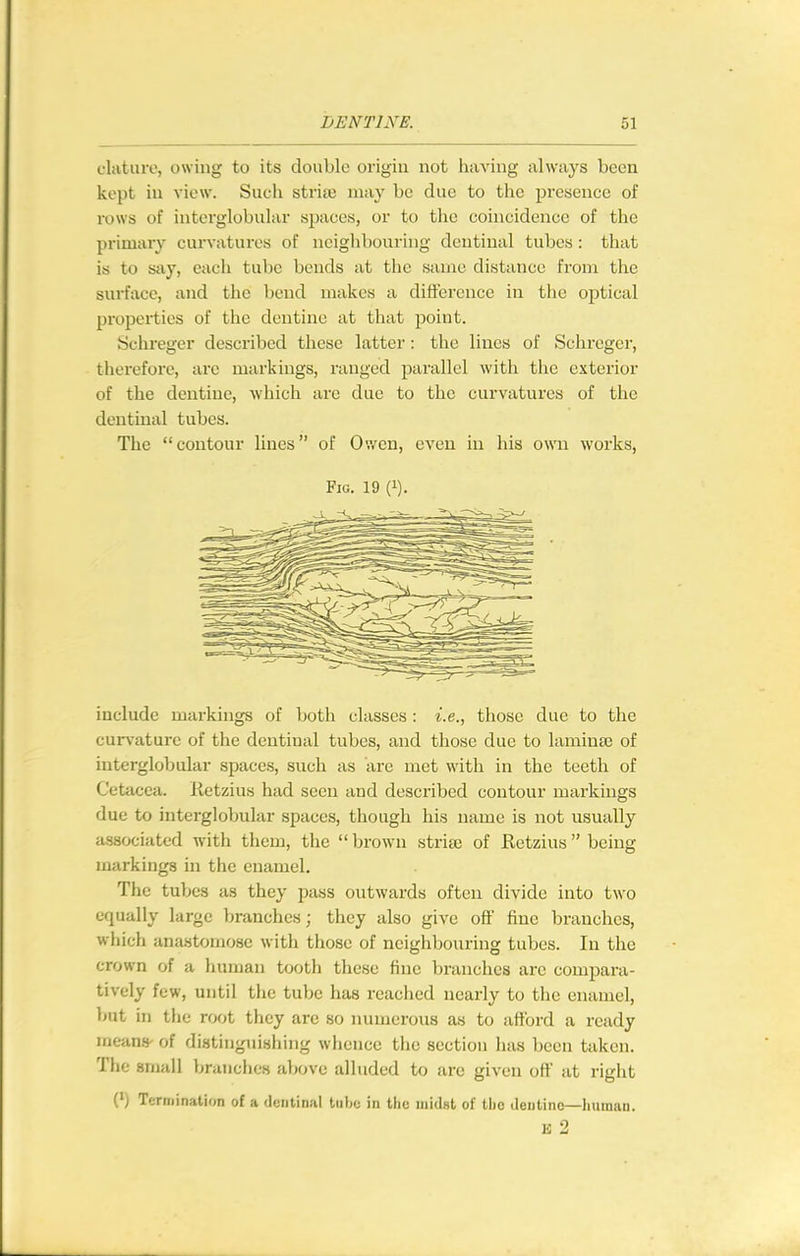 clature, owing to its double origin not having always been kept in view. Such striaj may be due to the i^resence of rows of interglobular spaces, or to the coincidence of the primary curvatures of neighbouring dentinal tubes : that is to say, each tube bends at the same distance from the surface, and the bend makes a difference in the optical properties of the dentine at that point. Schreger described these latter : the lines of Schreger, therefore, arc markings, ranged parallel with the exterior of the dentine, which are due to the curvatures of the dentinal tubes. The contour lines of Ov/en, even in his own works, Fig. 19 (1). include markings of both classes : i.e., those due to the cur\-ature of the dentinal tubes, and those due to lamina of interglobular spaces, such as are met with in the teeth of Cetacea. Ketzius had seen and described contour markings due to interglobular spaces, though his name is not usually associated with them, the  brown stria; of Retzius  being markings in the enamel. The tubes as they pass outwards often divide into two equally large branches; they also give off fine branches, wliich ana.stomosc with those of neighbouring tubes. In the crown of a human tooth these fine branches are compara- tively few, until the tube has reached nearly to the enamel, but in tlie root they are so numerous as to afford a ready moans' of distinguisliing wlience the section has been taken. The small branches above alluded to arc given off at right (') Termination of a dentinal lube in tiie midst of tlio dentine—human. E 2