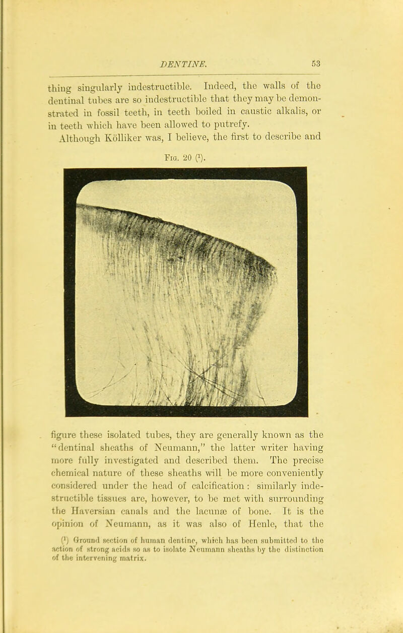 thing singularly indestructible. Indeed, the walls of the dentinal tubes are so indestructible that they may be demon- strated in fossil teeth, in teeth boiled in caustic alkalis, or in teeth which have been allowed to putrefy. Although KoUiker was, I believe, the first to describe and Fio. 20 (»). figure these isolated tubes, they are generally known as the dentinal sheaths of Neumann, tlie latter writer having more fully investigated and described them. The precise chemical nature of these sheaths will be more conveniently considered under the head of calcification : similarly inde- structible tissues are, however, to be met witl\ surrounding the Haversian canals and the lacuna) of bono. It is the opinion of Neumann, as it was also of Hcnle, that the (1) Ground Bection of human dentine, which ha.s been submitted to the action of strong acids so a.s to isolate Neumann sheaths l)y tiic distinction of the intervening matrix.