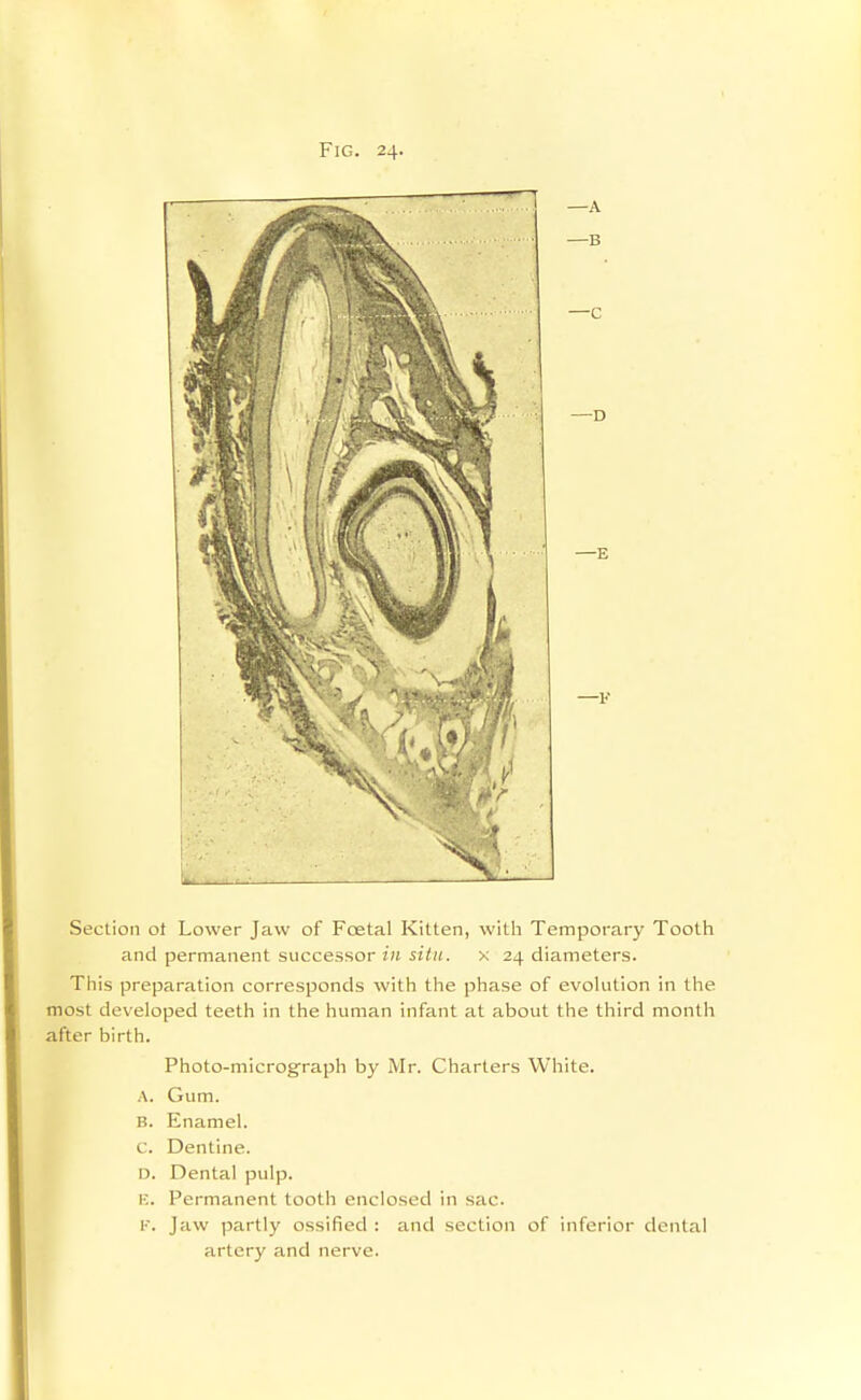 Section of Lower Jaw of Foetal Kitten, with Temporary Tooth and permanent successor 7'/i sj7;(. x 24 diameters. This preparation corresponds with the phase of evokition in the most developed teeth in the human infant at about the third month after birth. Photo-micrograph by Mr. Charters White. A. Gum. B. Enamel, c. Dentine. D. Dental pulp. E. Permanent tooth enclosed in sac. I. Jaw partly ossified : and section of inferior dental artery and nerve.