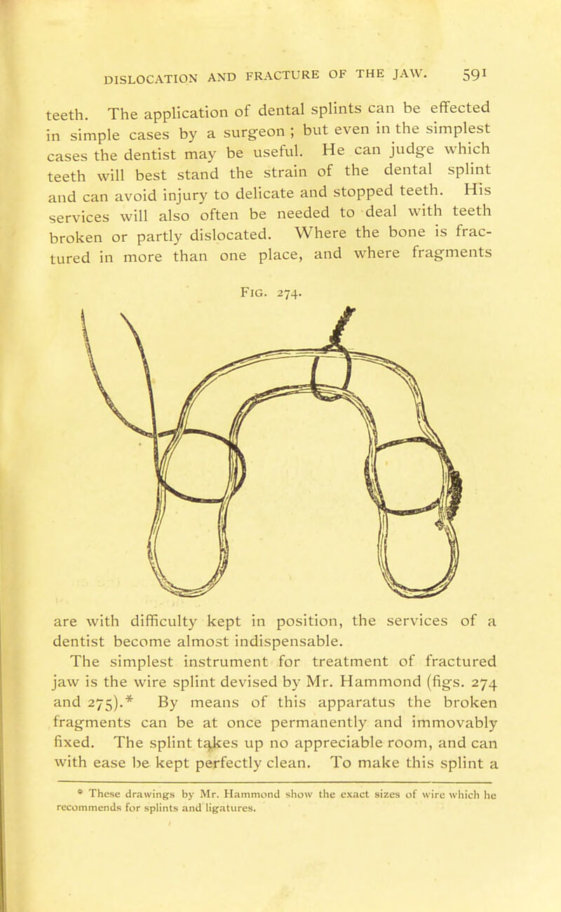 teeth. The application of dental splints can be effected in simple cases by a surgeon ; but even in the simplest cases the dentist may be useful. He can judge which teeth will best stand the strain of the dental splint and can avoid injury to delicate and stopped teeth. His services will also often be needed to deal with teeth broken or partly dislocated. Where the bone is frac- tured in more than one place, and where fragments Fig. 274. are with difficulty kept in position, the services of a dentist become almost indispensable. The simplest instrument for treatment of fractured jaw is the wire splint devised by Mr. Hammond (figs. 274 and 275).* By means of this apparatus the broken fragments can be at once permanently and immovably fixed. The splint tj^kes up no appreciable room, and can with ease be kept perfectly clean. To make this splint a ' These drawings by Mr. Hammond show the exact sizes of wire which he recommends for splints and ligatures.