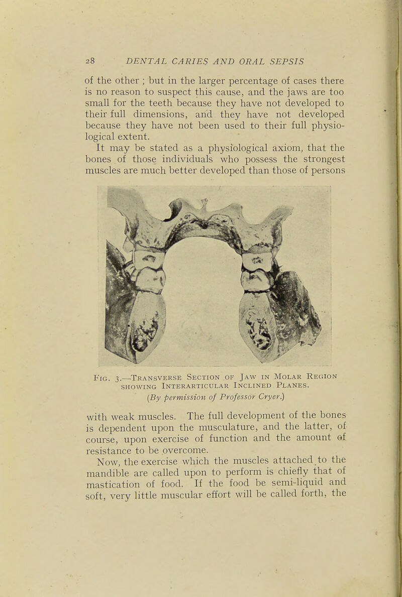 of the other ; but in the larger percentage of cases there is no reason to suspect this cause, and the jaws are too small for the teeth because they have not developed to their full dimensions, and they have not developed because they have not been used to their full physio- logical extent. It may be stated as a physiological axiom, that the bones of those individuals who possess the strongest muscles are much better developed than those of persons Fig. 3.—^Transverse Section of Jaw in Molar Rec.ion SHOWING InTERARTICULAR INCLINED PlANES. {By pevmission of Professor Cryer.) with weak muscles. The full development of the bones is dependent upon the musculature, and the latter, of course, upon exercise of function and the amount of resistance to be overcome. Now, the exercise which the muscles attached to the mandible are called upon to perform is chiefly that of mastication of food. If the food be semi-liquid and soft, very little muscular effort will be called forth, the