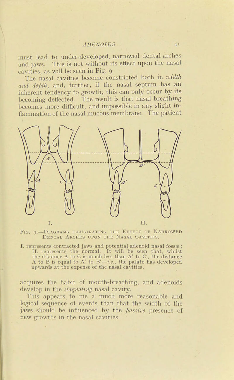 must lead to under-developed, narrowed dental arches and jaws. This is not without its effect upon the nasal cavities, as will be seen in Fig. 9. The nasal cavities become constricted both in width and depth, and, further, if the nasal septum has an inherent tendency to growth, this can only occur by its becoming deflected. The result is that nasal breathing becomes more difficult, and impossible in any slight in- flammation of the nasal mucous membrane. The patient Fig. 9.—Diagrams illustrating the Effect of Narrowed Dental Arches upon the Nasal Cavities. I. represents contracted jaws and potential adenoid nasal fossae ; II. represents the normal. It will be seen that, whilst the distance A to C is much less than A' to C, the distance A to B is equal to A' to B'—i.e., the palate has developed upwards at the expense of the nasal cavities. acquires the habit of mouth-breathing, and adenoids develop in the stagnating nasal cavity. This appears to me a much more reasonable and logical sequence of events than that the width of the jaws should be influenced by the passive presence of new growths in the nasal cavities.