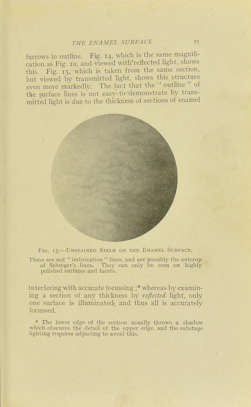 furrows in outline. Fig. 14, which is the same magnifi- cation as Fig. 10, and viewed with'reflected Hght, shows this. Fig. 15, which is taken from the same section, but viewed by transmitted hght, shows this structure even more markedly. The fact that the  outline  of the surface lines is not easy- to-'demonstrate by trans- mitted light is due to the thickness of sections of enamel Fig. 13.—Unstained Stride on the Enamel Surface. These are not  imbrication  lines, and are'possibly the outcrop of Schreger's lines. They can only be seen on highly polished surfaces and facets. interfering with accurate focussing ;* whereas by examin- ing a section of any thickness by reflected light, only one surface is illuminated-; and thus all is accurately focussed. * The lower edge of the section usually throws a shadow which obscures the detail of the upper edge, and the substagc lighting requires adjusting to avoid this.