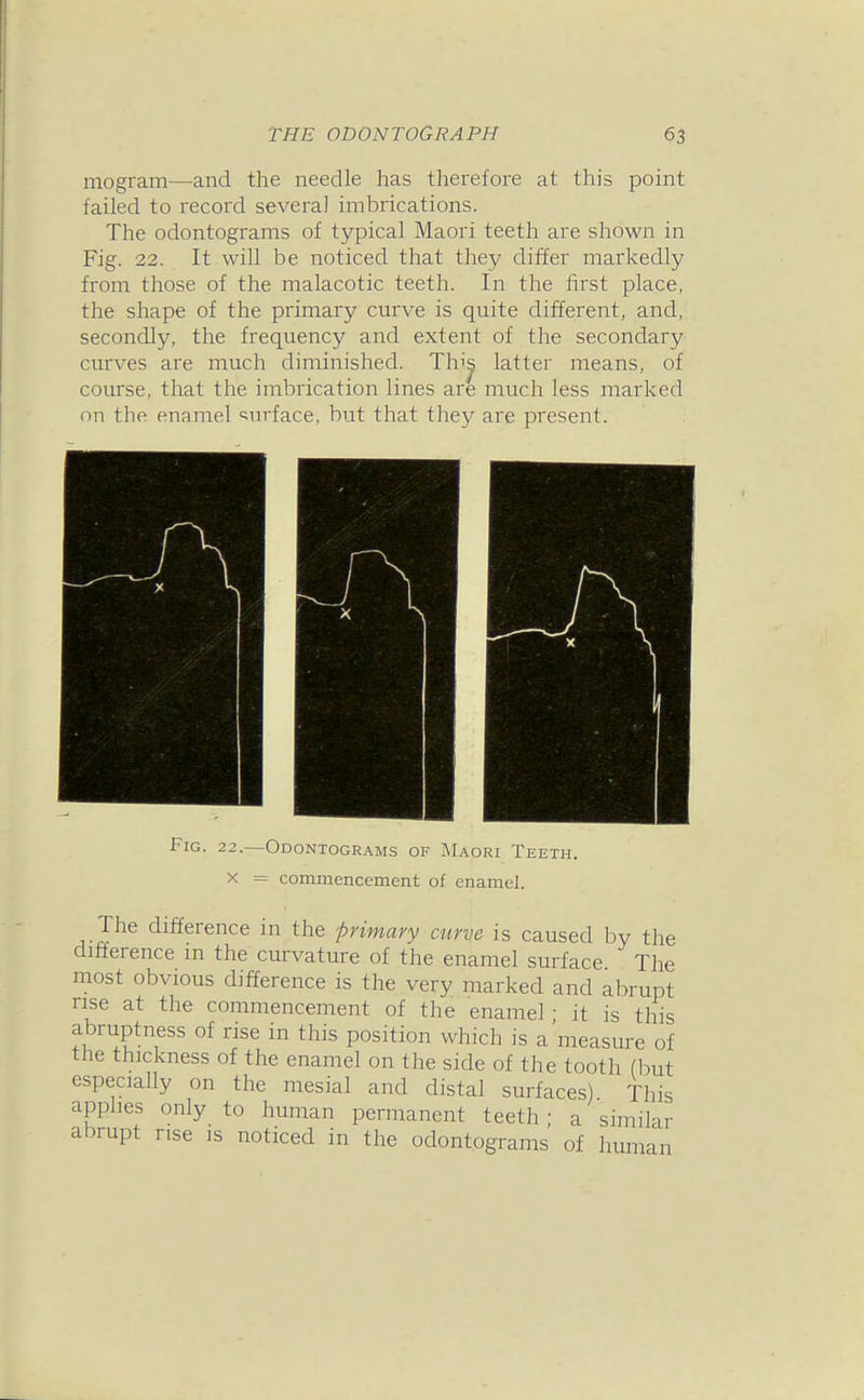 mogram—and the needle has therefore at this point failed to record several imbrications. The odontograms of typical Maori teeth are shown in Fig. 22. It will be noticed that they differ markedly from those of the malacotic teeth. In the first place, the shape of the primary cmve is quite different, and, secondly, the frequency and extent of the secondary curves are much diminished. Thi^ latter means, of course, that the imbrication lines are much less marked on the enamel ^^nrface, but that they are present. Fig. 22.—Odontograms of Maori Teeth. X = commencement of enamel. The difference in the primary curve is caused by the difference m the curvature of the enamel surface The most obvious difference is the very marked and abrupt rise at the commencement of the enamel - it is tliis abruptness of rise in this position which is a'measure of the thickness of the enamel on the side of the tooth (but especially on the mesial and distal surfaces). This applies only to human permanent teeth- a similar abrupt rise is noticed in the odontograms of human