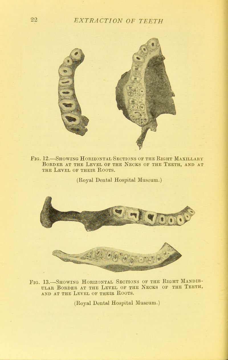 Fig. 12.—Showing Horizontal Sections of the Right Maxillary- Border at the Level of the Necks of the Teeth, and at the Level of their Roots. (Royal Dental Hospital Museum.) Fig. 13.—Showing Horizontal Sections of the Right Mandib- ular Border at the Level of the Necks of the Teeth, and at the Level of their Roots. (Royal Dental Hospital Museum.)