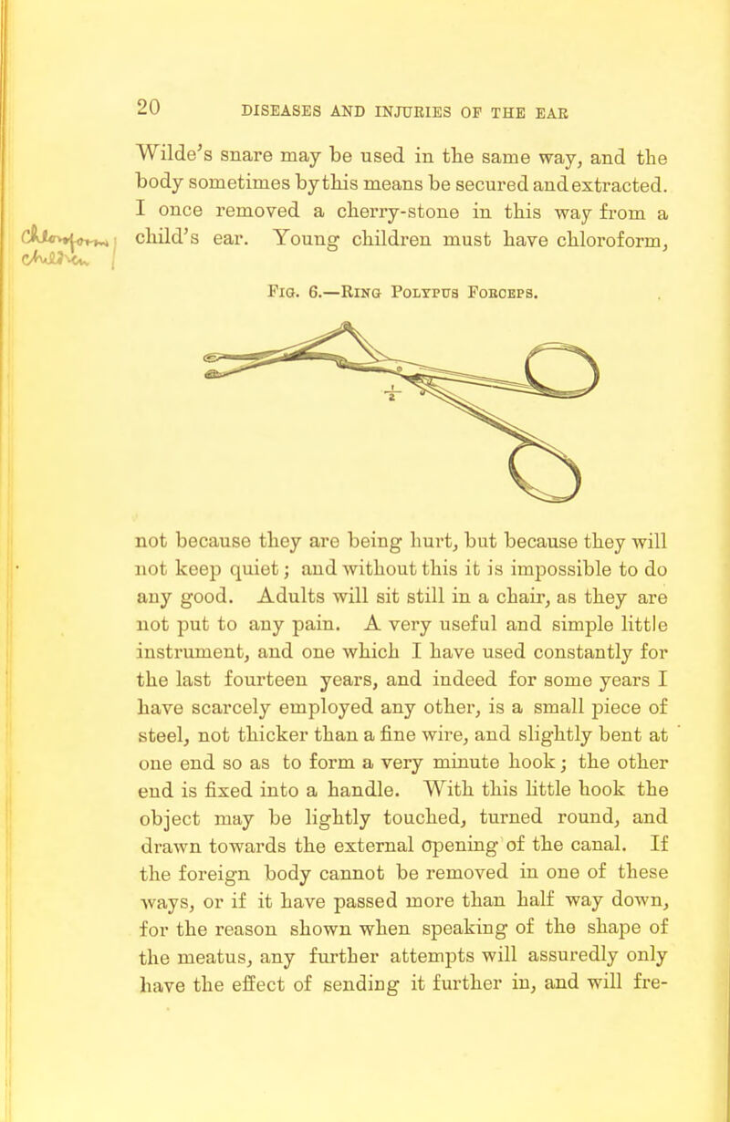 Wilde's snare may be used in tlie same way, and the body sometimes by this means be secured and extracted. I once removed a cherry-stone in this way from a CiJ^nt^i^^■, child's ear. Young children must have chloroform, Fig. 6.—Ring Poitpus Poeobps, not because they are being hurt, but because they will not keep quiet; and without this it is impossible to do any good. Adults will sit still in a chair, as they are not put to any pain. A very useful and simple little instrument, and one which I have used constantly for the last fourteen years, and indeed for some years I have scarcely employed any other, is a small piece of steel, not thicker than a fine wire, and slightly bent at one end so as to form a very minute hook; the other end is fixed into a handle. With this little hook the object may be lightly touched, turned round, and drawn towards the external opening of the canal. If the foreign body cannot be removed in one of these ways, or if it have passed more than half way down, for the reason shown when speaking of the shape of the meatus, any fm-ther attempts will assuredly only have the effect of sending it further in, and will fre-