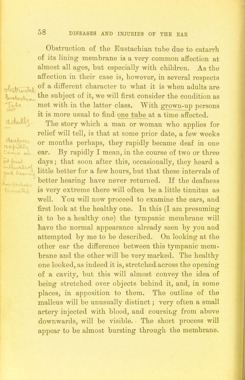 Obstruction of tbe Eustachian tube due to catarrh of its lining membrane is a very common affection at almost all ages, but especially with children. As the affection in their case is, however, in several respects o^rjjt^^tJ ^ different character to what it is when adults are V^cKcl subject of it, we will first consider the condition as TVU met with in the latter class. With grown-up persons it is more usual to find one tube at a time affected. ^-i^>'*^ ■ The story which a man or woman who applies for relief will tell, is that at some prior date, a few weeks rvajofec? months perhaps, they rapidly became deaf in one Ccv^wwt Ju ear. By rapidly I mean, in the course of two or three I^uaA days; that soon after this, occasionally, they heard a ; J!^^ little better for a few hours, but that these intervals of , ^ better hearing have never returned. If the deafness is very extreme there will often be a little tinnitus as well. You will now proceed to examine the ears, and first look at the healthy one. In this (I am presuming it to be a healthy one) the tympanic membrane will have the normal appearance already seen by you and attempted by me to be described. On looking at the other ear the difference between this tympanic mem- brane and the other will be very marked. The healthy one looked, as indeed it is, stretched across the opening of a cavity, but this will almost convey the idea of being stretched over objects behind it, and, in some places, in apposition to them. The outline of the malleus will be unusually distinct; very often a small artery injected with blood, and coursing from above downwards, will be visible. The short process will appear to be almost bursting through the membrane.