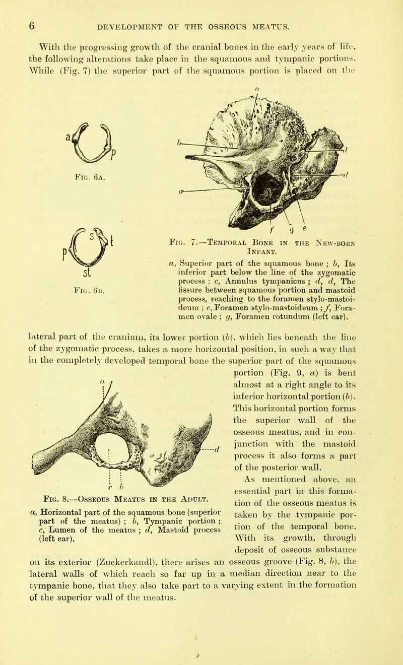 Witli tlic progressing growth of the cranial bones in the early years of life, the following alterations take place in the squamous and tympanic portions. While (Fig. 7) the superior part of the sqixaraoxis portion is placed on tlir Fig. 6a. f 'J ^ Fig. 7-—Temporal Bone in the Nkw-bokn INI'ANT. a, vSuperior part of the squaniou.s bone ; Its inferior part below the Hne of the zygomatic process : c, Annuhis tympanicus ; <l, d. The fissure between squamous portion and mastoid process, reaching to the foramen st^lo-mastoi- deum : e. Foramen stylo-mastoideum ; J\ Fora- men ovale : 7, For.amen rotundum (left ear). lateral part of the cranium, its lower portion (h). which lies l)eneath tJie line of the zygomatic process, takes a more horizontal position, in .such a way that in the completely developed temporal hone the superior part of the squamous portion (Fig. 9, a) is bent almost at a right angle to its inferior horizontal portion {h). This horizontal portion forms the superior wall of the osseous meatus, and in con- junction with the mastoid process it also forms a part of the posterior wall. As mentioned above, an essential part in this forma- tion of the osseous meatus is taken hy the t^^Tupanic por- tion of the temporal bone. With its growth, through deposit of osseous substance on its exterior (Zuckerkandl), there arises an osseous groove (Fig. 8, h), the lateral walls of which reach so far up in a median direction near to the tympanic bone, that they also take part to a varying extent in the formation of the superior wall of the meatus. Fig. 8.- r h -Osseous Meatus in the Adult. rt, Horizontal part of the squamous bone (superior part of the meatus) ; h, Tympanic portion ; c. Lumen of the meatus ; d, Mastoid process (left ear). >