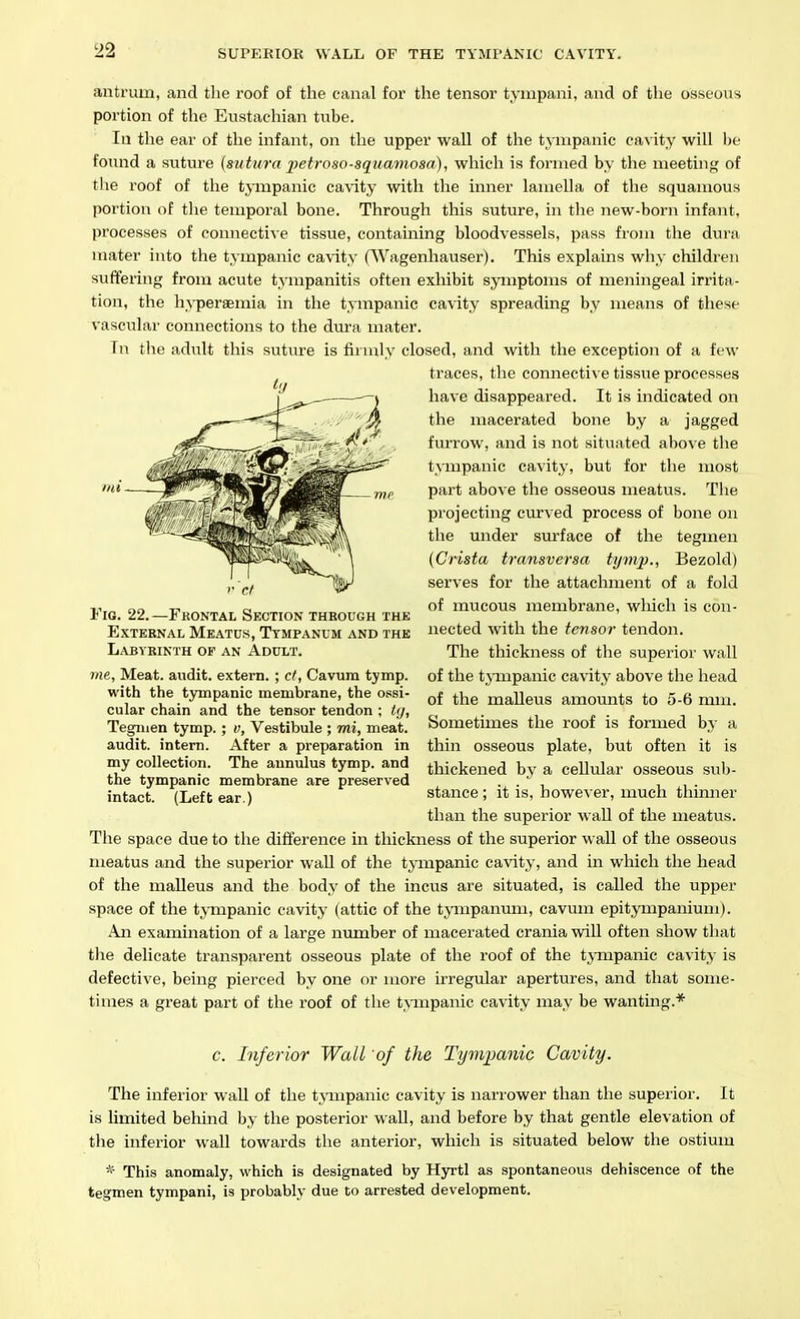 antrum, and tlie roof of the canal for the tensor tynipani, and of the osseons portion of the Eustachian tube. Ill the ear of the infant, on the upper wall of the tympanic ca\'ity will Ije found a suture (sutura jJetroso-squamosa), which is formed by tlie meeting of the roof of the tympanic cavity with the inner lamella of the squamous portion of the temporal bone. Through this suture, in the new-born infant, processes of connective tissue, containing bloodvessels, pass from the dura mater into the t.ympanic cavity (Wagenhaviser). This explains why children suffering from acute tympanitis often exhibit symptoms of meningeal irrita- tion, the h.'V'peraemia in the tympanic cavity spreading by means of these vasculai' connections to the dura mater. Tn the adult this suture is firmly closed, and with the exception of a few traces, the connective tissue processes have disappeared. It is indicated on the macerated bone by a jagged furrow, and is not situated above the tympanic cavity, but for the most part above the osseous meatus. The projecting curved process of bone on the under surface of the teginen {Crista transversa tymp., Bezold) serves for the attachment of a fold of mucous membrane, which is con- nected with the tensor tendon. The thickness of the superior wall of the tpupanic cavity above the head of the malleus amounts to 5-6 mm. Sometimes the roof is formed by a thin osseous plate, but often it is thickened by a cellular osseous sub- stance ; it is, however, much thinner than the superior waU of the meatus. The space due to the difference in thickness of the superior wall of the osseous meatus and the superior wall of the tympanic cavity, and in which the head of the malleus and the body of the incus are situated, is called the upper space of the tympanic cavity (attic of the tympanum, cavuin epitympaniuni). An examination of a large number of macerated crania wiU often show that the delicate transparent osseous plate of the roof of the tjTupanic cavity is defective, being pierced by one or more irregular apertures, and that some- times a great part of the roof of the tympanic cavity may be wanting.* c. Inferior WaU of the Tympanic Cavity. The inferior wall of the tjmpanic cavity is narrower than the superior. It is limited behind by the posterior wall, and before by that gentle elevation of the inferior wall towards the anterior, which is situated below the ostium * This anomaly, which is designated by Hyrtl as spontaneous dehiscence of the tegmen tympani, is probably due to arrested development. mi Fig. 22. —Frontal Section through the External Meatus, Tympanum and the Labyrinth of an Adult. me, Meat, audit, extern. ; ct, Cavum tymp. with the tympanic membrane, the ossi- cular chain and the tensor tendon ; t(/, Tegnien tymp. ; v. Vestibule ; mi, meat, audit, intern. After a preparation in my collection. The annulus tymp. and the tympanic membrane are preserved intact. (Left ear.)