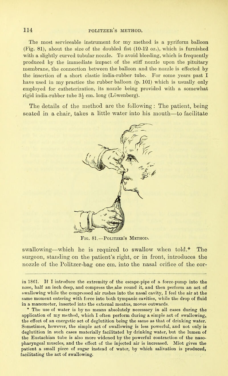 The most serviceable instrument for my method is a pyriform balloon (Fig. 81), about the size of the doubled fist (10-12 oz.), which is furnished with a shghtly cm-ved tubular nozzle. To avoid bleeding, which is frequently produced by the immediate impact of the stiff nozzle upon the pitmtary membrane, the connection between the balloon and the nozzle is effected by the insertion of a short elastic india-rubber tube. For some years past I have used in my practice the rubber balloon (p. 101) which is usually only employed for catheterization, its nozzle being provided with a somewhat rigid india-rubber tube 3i cm. long (Luwenberg). The details of the method are the following : The patient, being seated in a chair, takes a little water into his mouth—to facilitate swallowing—which he is required to swallow when told.* The surgeon, standing on the patient's right, or in front, introduces the nozzle of the Politzer-bag one cm. into the nasal orifice of the cor- in 1861. If I introduce the extremity of the escape-pipe of a force-pump into the nose, half an inch deep, and compress the alte round it, and then perform an act of swallowing while the compressed air rushes into the nasal cavity, I feel the air at the same moment entering with force into both tympanic cavities, while the drop of fluid in a manometer, inserted into the external meatus, moves outwards. * The use of water is by no means absolutely necessary in all cases during the application of my method, which I often perform during a simple act of swallowing, the eflfect of an energetic act of deglutition being the same as that of drinking water. Sometimes, however, the simple act of swallowing is less powerful, and not only is deglutition in such cases materially facilitated by drinking water, but the lumen of the Eustachian tube is also more widened by the powerful contraction of the naso- pharyngeal muscles, and the eflfect of the injected air is increased. Miot gives the patient a small piece of sugar instead of water, by which salivation is produced, facilitating the act of swallowing. Fig. 81.—Politzer's Method.