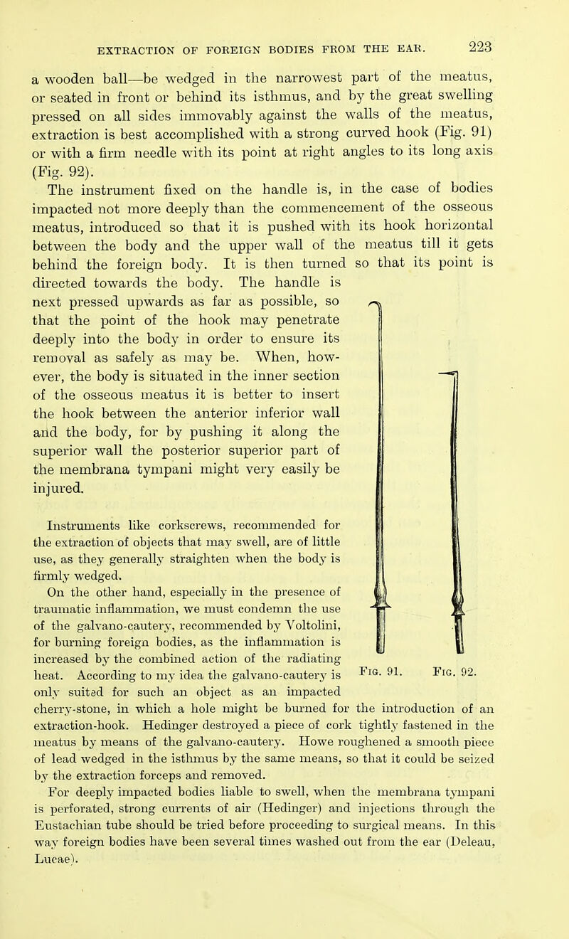 1 a wooden ball—be wedged in the narrowest part of the meatus, or seated in front or behind its isthmus, and by the great swelling pressed on all sides immovably against the walls of the meatus, extraction is best accompHshed with a strong curved hook (Kg. 91) or with a firm needle with its point at right angles to its long axis (Fig. 92). The instrument fixed on the handle is, in the case of bodies impacted not more deeply than the commencement of the osseous meatus, introduced so that it is pushed with its hook horizontal between the body and the upper wall of the meatus till it gets behind the foreign body. It is then turned so that its point is directed towards the body. The handle is next pressed upwards as far as possible, so that the point of the hook may penetrate deeply into the body in order to ensure its removal as safely as may be. When, how- ever, the body is situated in the inner section of the osseous meatus it is better to insert the hook between the anterior inferior wall and the body, for by pushing it along the superior wall the posterior superior part of the membrana tympani might very easily be injured. Instruments like corkscrews, recommended for the extraction of objects that may swell, are of little use, as they generally straighten when the body is firmly wedged. On the other hand, especially in the presence of traumatic inflammation, we must condemn the use of the galvano-cautery, recommended by Voltolini, for burning foreign bodies, as the inflammation is increased by the combined action of the radiating heat. According to my idea the galvano-cautery is only suited for such an object as an impacted cherry-stone, in which a hole might be burned for the introduction of an extraction-hook. Hedinger destroyed a piece of cork tightly fastened in the meatus by means of the galvano-cautery. Howe roughened a smooth piece of lead wedged in the isthmus by the same means, so that it could be seized by the extraction forceps and removed. For deeply impacted bodies liable to sweU, when the membrana tympani is perforated, strong currents of air (Hedinger) and injections through the Eustachian tube shordd be tried before proceeding to surgical means. In this way foreign bodies have been several times washed out from the ear (Deleau, Lucae). Fig. 91. Fig. 92.