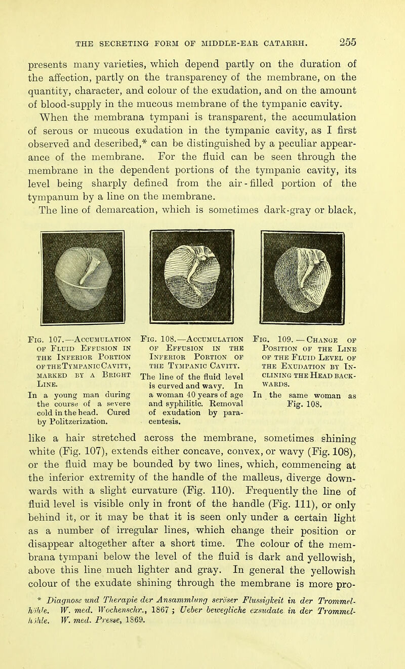 presents many varieties, which depend partly on the duration of the affection, partly on the transparency of the membrane, on the quantity, character, and colour of the exudation, and on the amount of blood-supply in the mucous membrane of the tympanic cavity. When the membrana tympani is transparent, the accumulation of seroiis or mucous exudation in the tympanic cavity, as I first observed and described,* can be distinguished by a peculiar appear- ance of the membrane. For the fluid can be seen through the membrane in the dependent portions of the tympanic cavity, its level being sharply defined from the air - filled portion of the tympanum by a line on the membrane. The line of demarcation, which is sometimes dark-gray or black, Fig. 107.—Accumulation OF Fluid Effusion in THE Inferior Portion OF theTympanic Cavity, marked by a bright Line. In a young man during the course of a severe cold in the head. Cured by Politzerization. Fig. 108.—Accumulation OF Effusion in the Inferioe Portion of THE Tympanic Cavity. The line of the fluid level is curved and wavy. In a woman 40 years of age and syphilitic. Removal of exudation by para- centesis. Fig. 109.—Change op Position of the Line of the Fluid Level of THE Exudation by In- clining the Head back- wards. In the same woman as Fig. 108. like a hair stretched across the membrane, sometimes shining white (Fig. 107), extends either concave, convex, or wavy (Fig. 108), or the fluid may be bounded by two lines, which, commencing at the inferior extremity of the handle of the malleus, diverge down- wards with a slight curvature (Fig. 110). Frequently the line of fluid level is visible only in front of the handle (Fig. Ill), or only behind it, or it may be that it is seen only under a certain light as a number of irregular lines, which change their position or disappear altogether after a short time. The colour of the mem- brana tympani below the level of the fluid is dark and yellowish, above this line much lighter and gray. In general the yellowish colour of the exudate shining through the membrane is more pro- * Diagnose und Therapie der Ansammhivg sero.ter FlussigJceit in der Trommel- h We. W. med. Wochenschr., 1867 ; Ueber beivegliche exmdate in der Trommd- kihle. W. med. Prense, 1869.